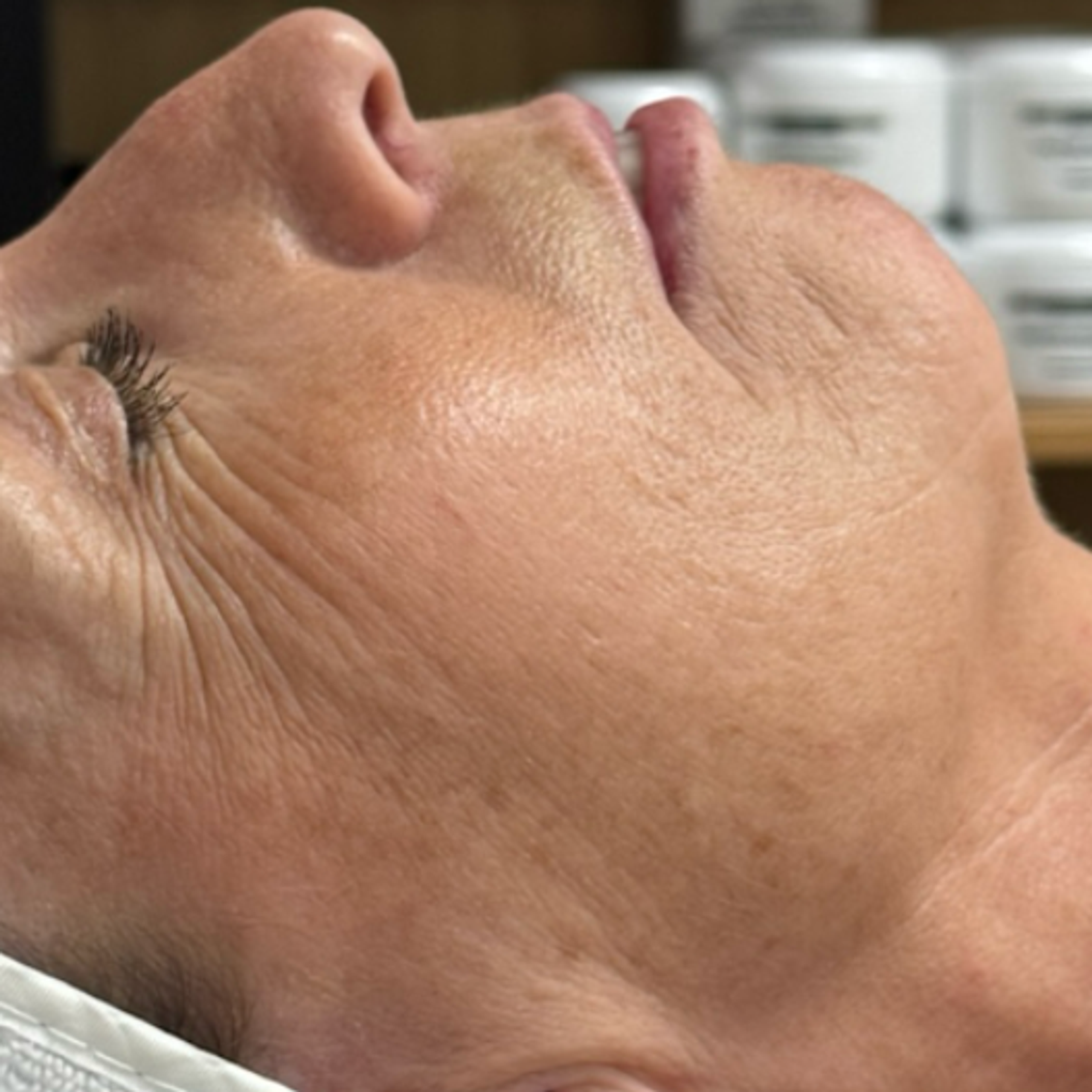 a woman's face, showing wrinkles around eyes and neck