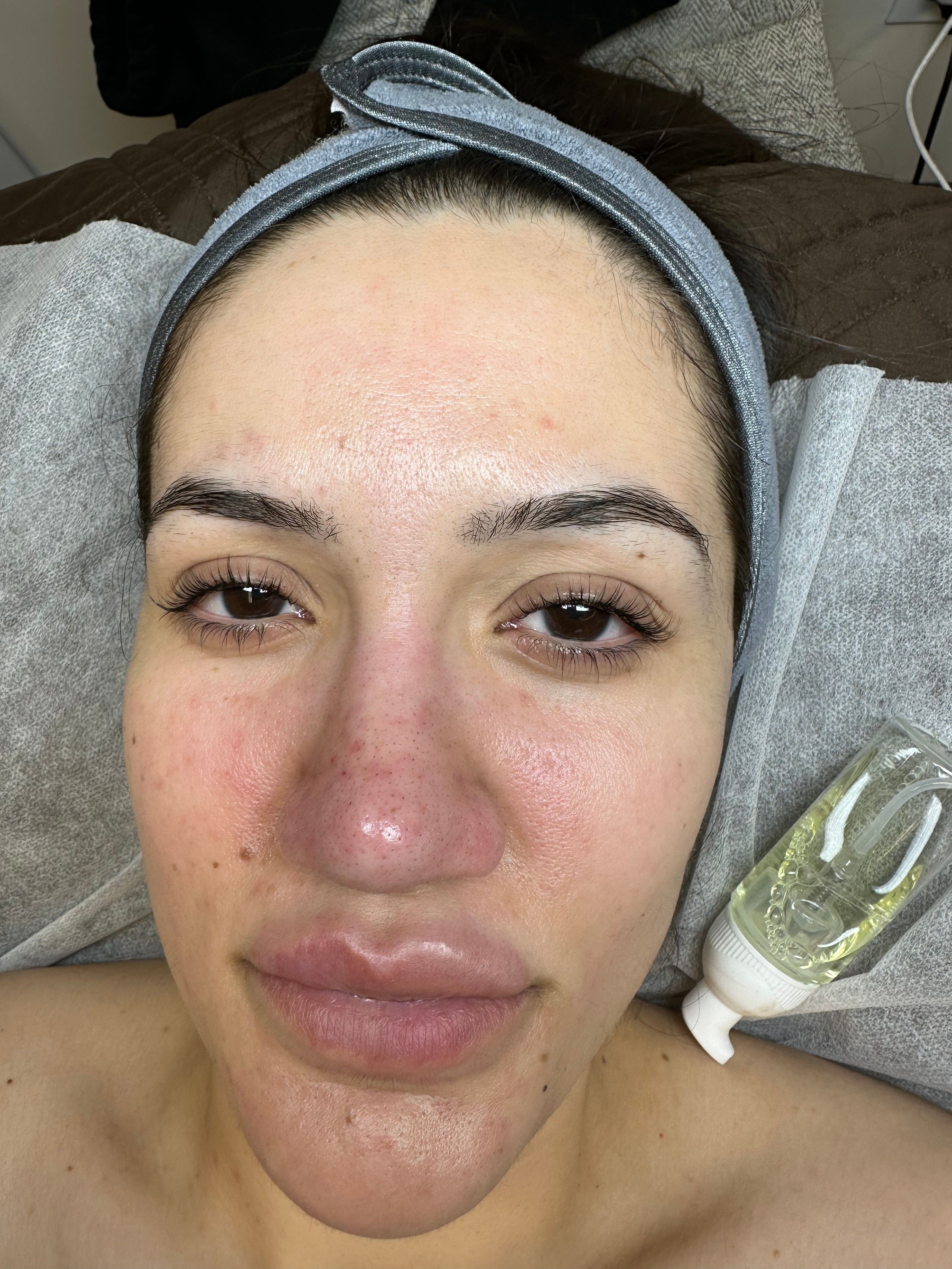 Right eye with long, curled lashes after treatment.