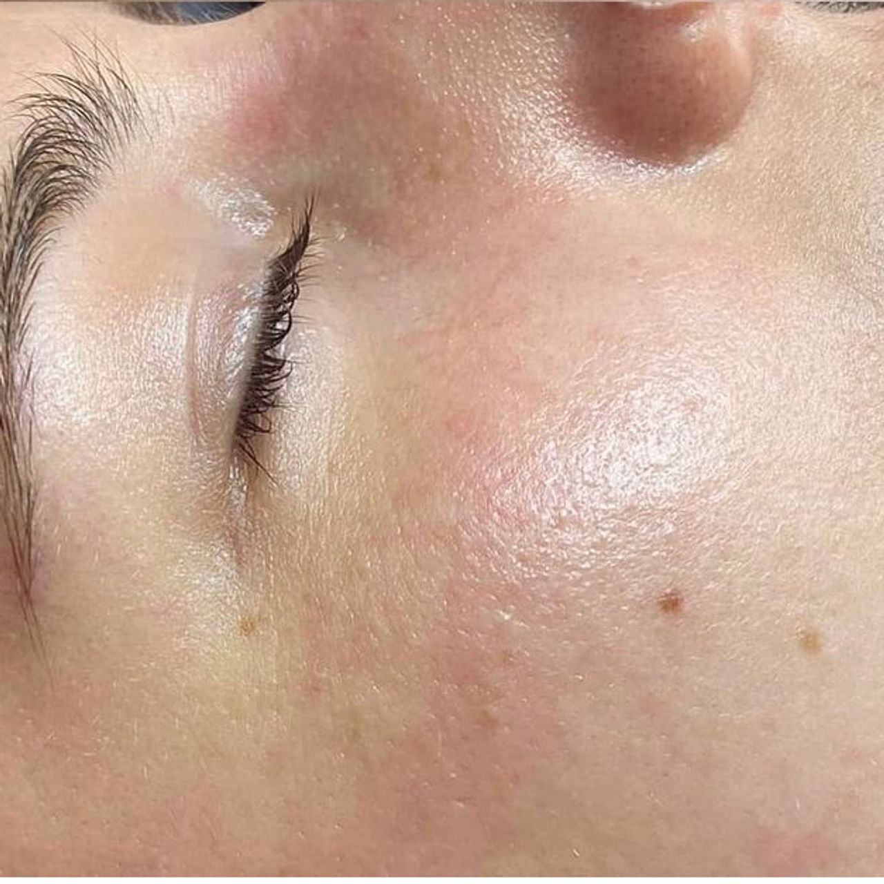 Close-up of a person's face with a closed eye and dewy skin.