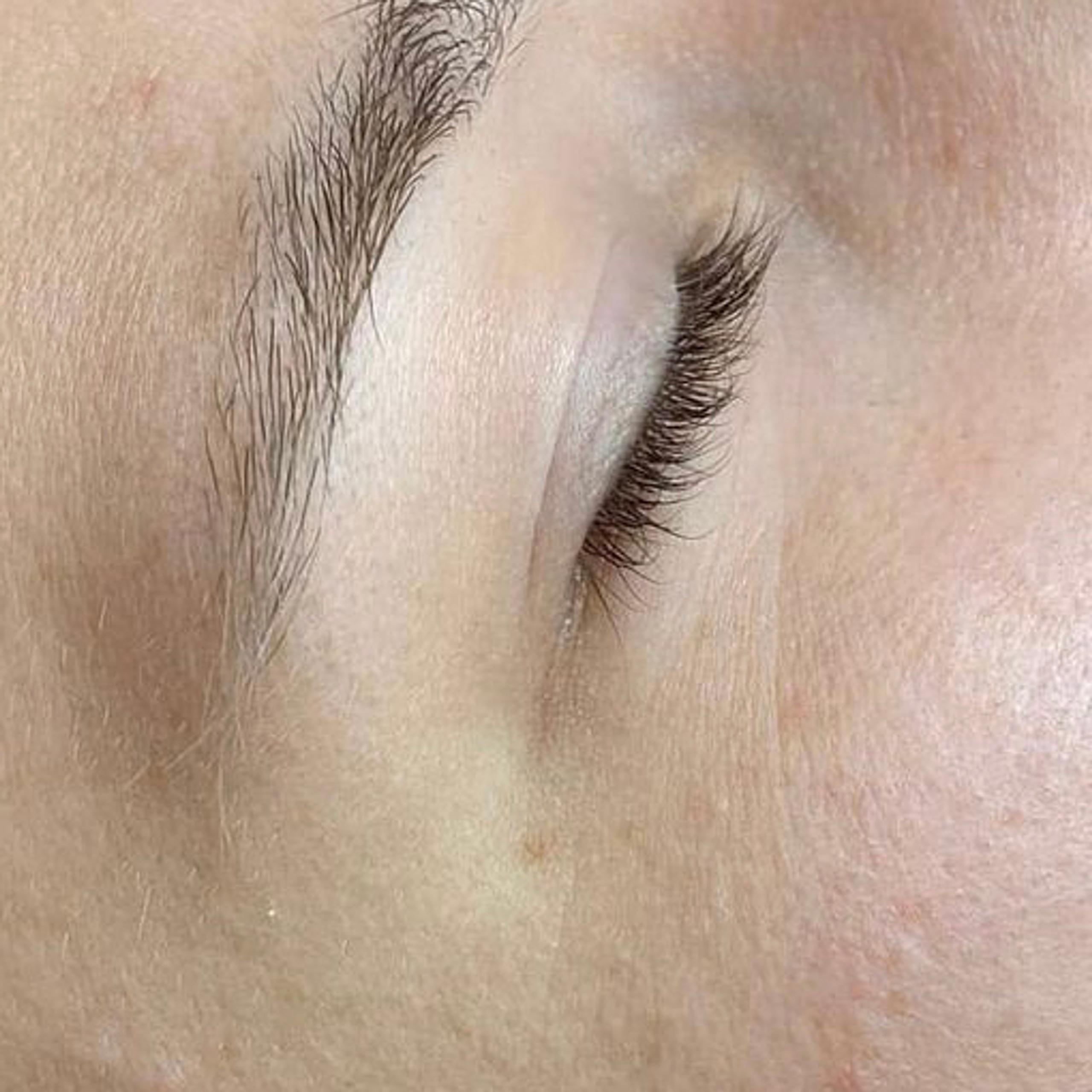 Close-up of a person's face with closed eyes and dry skin flaky skin.