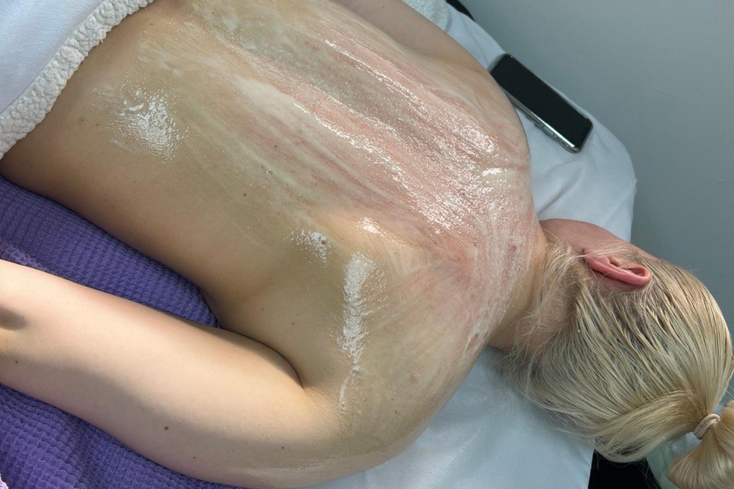A person lying face down on a treatment table, with their back covered in a creamy mask