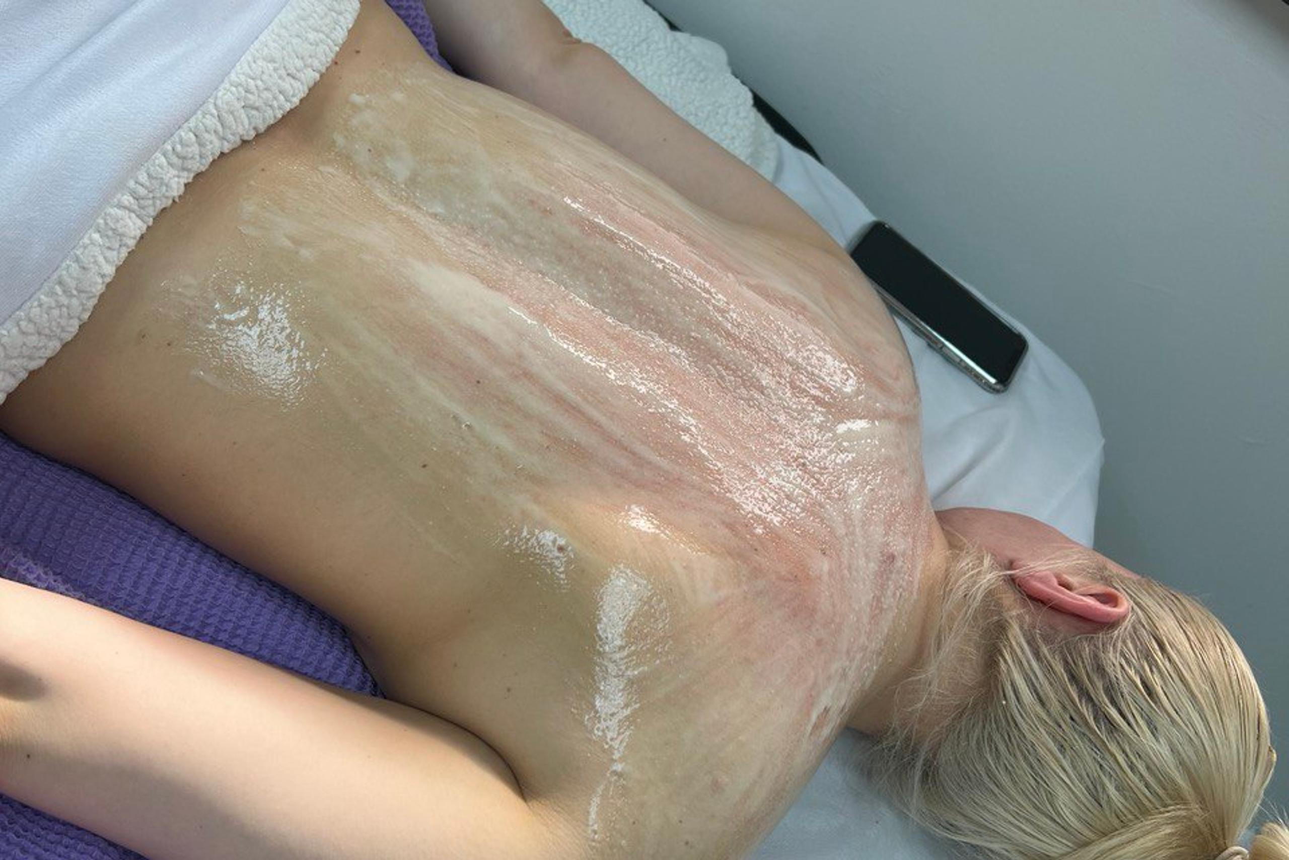 A person's back covered in a white scrub or mask on a treatment bed.