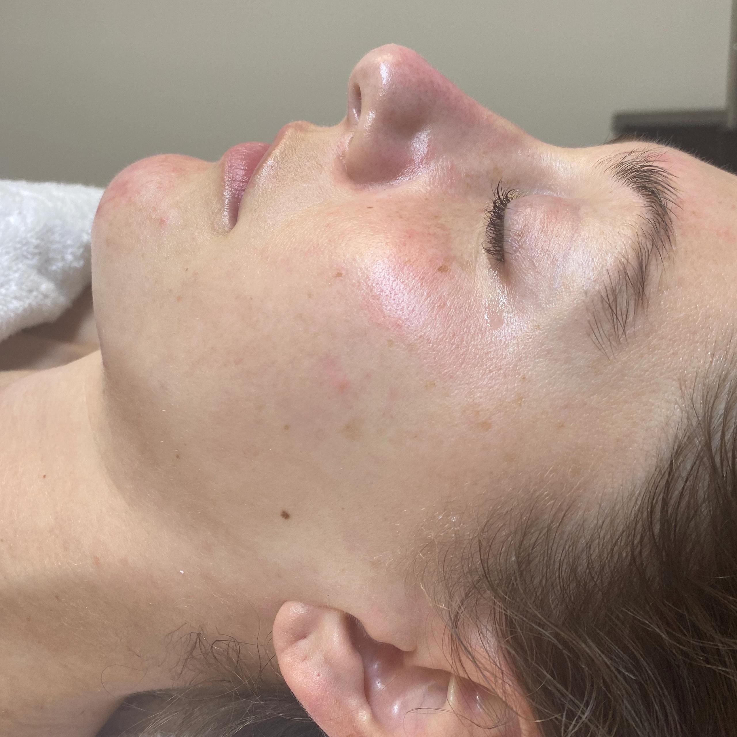 Side profile of a person's face with closed eyes, showing bright, hydrated skin.