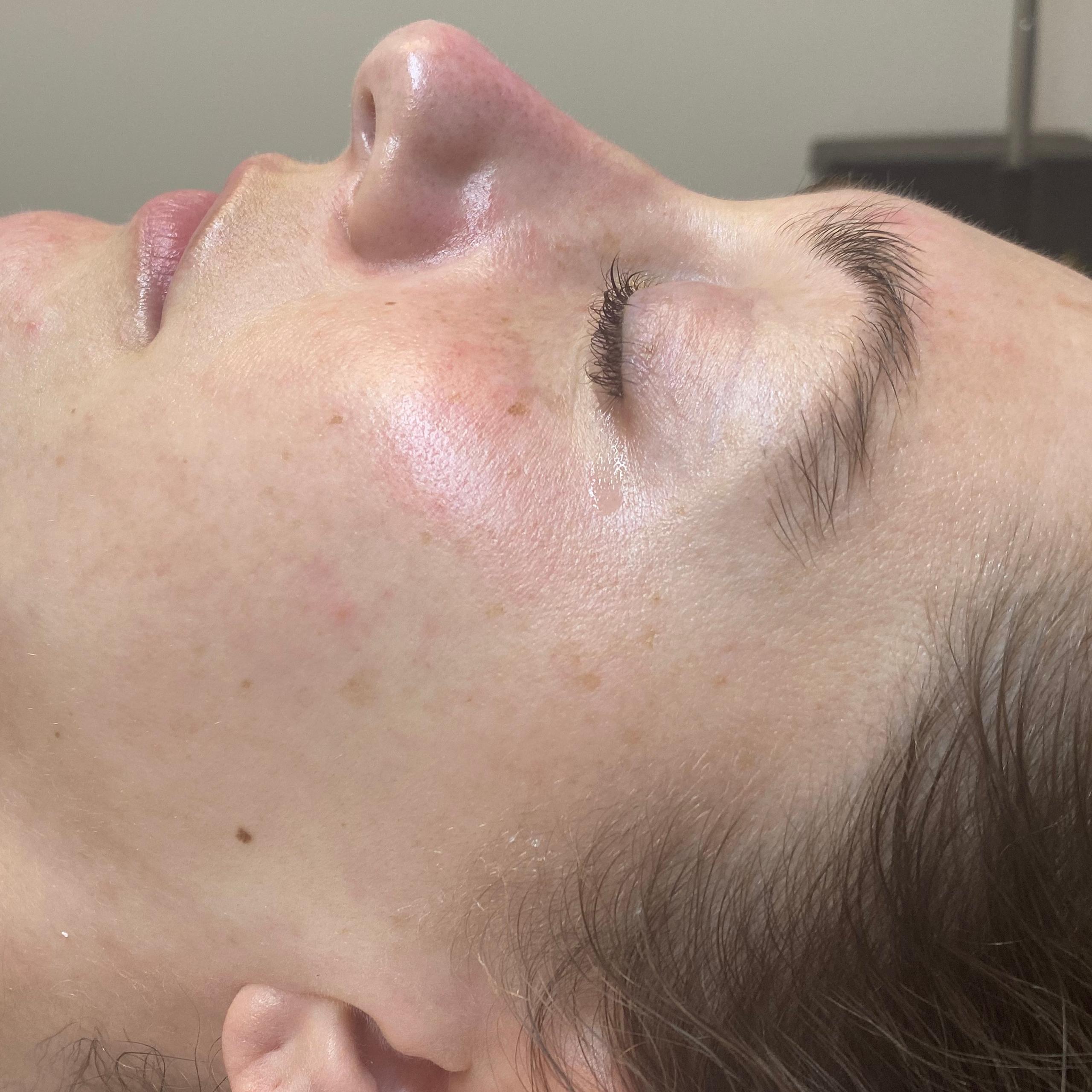 Side profile of a person's face with closed eyes, showing bright, hydrated skin.