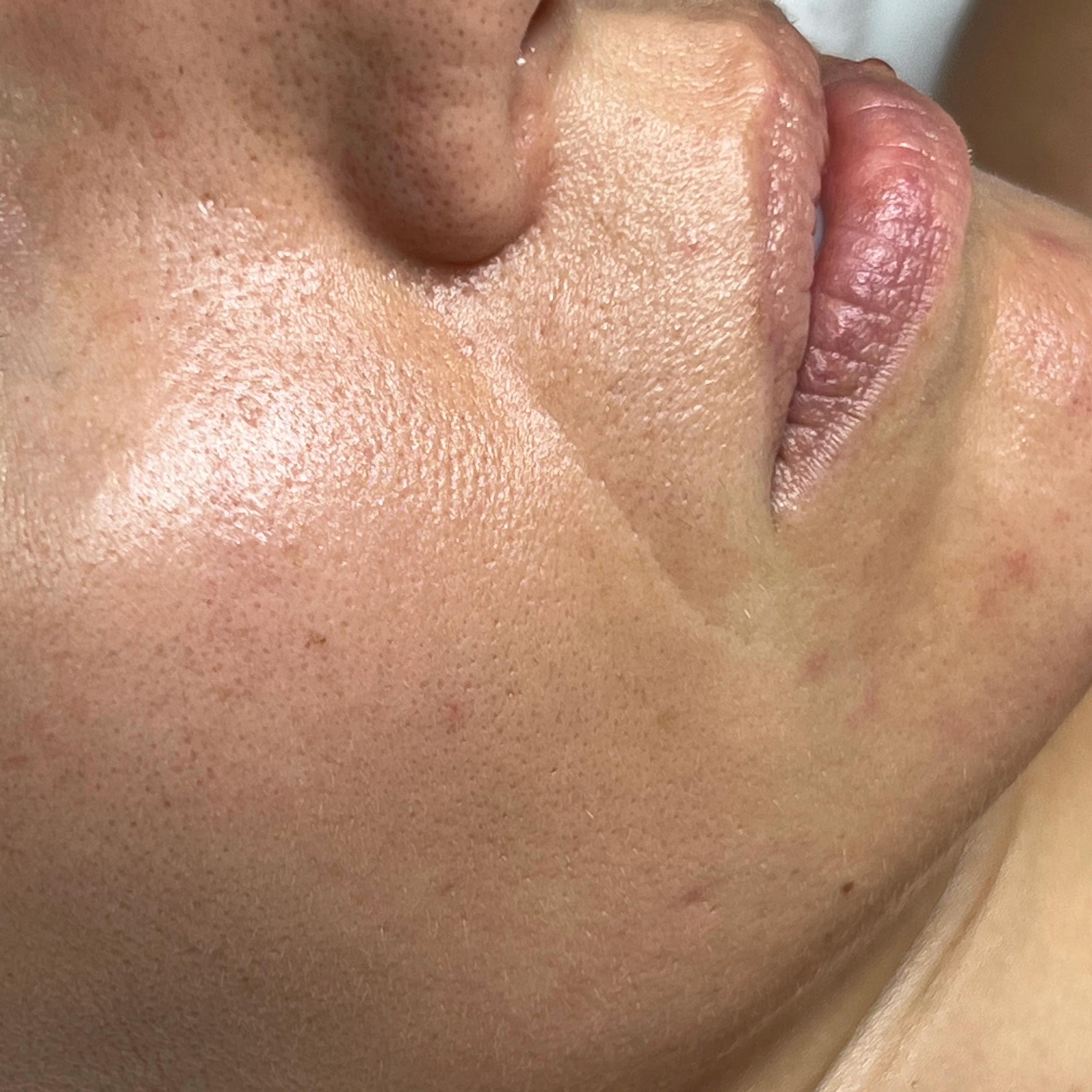 Close-up side profile of a person's face, showing a detailed skin texture.