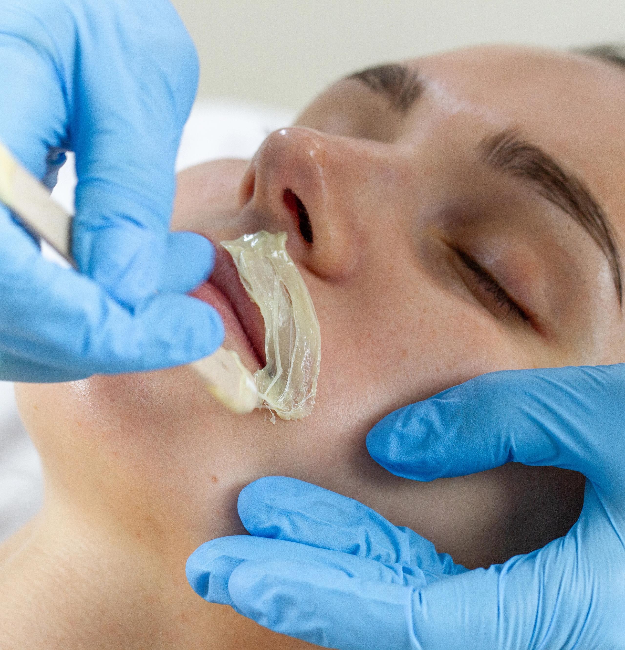 A gloved hand applies wax to a woman's upper lip with an applicator stick.