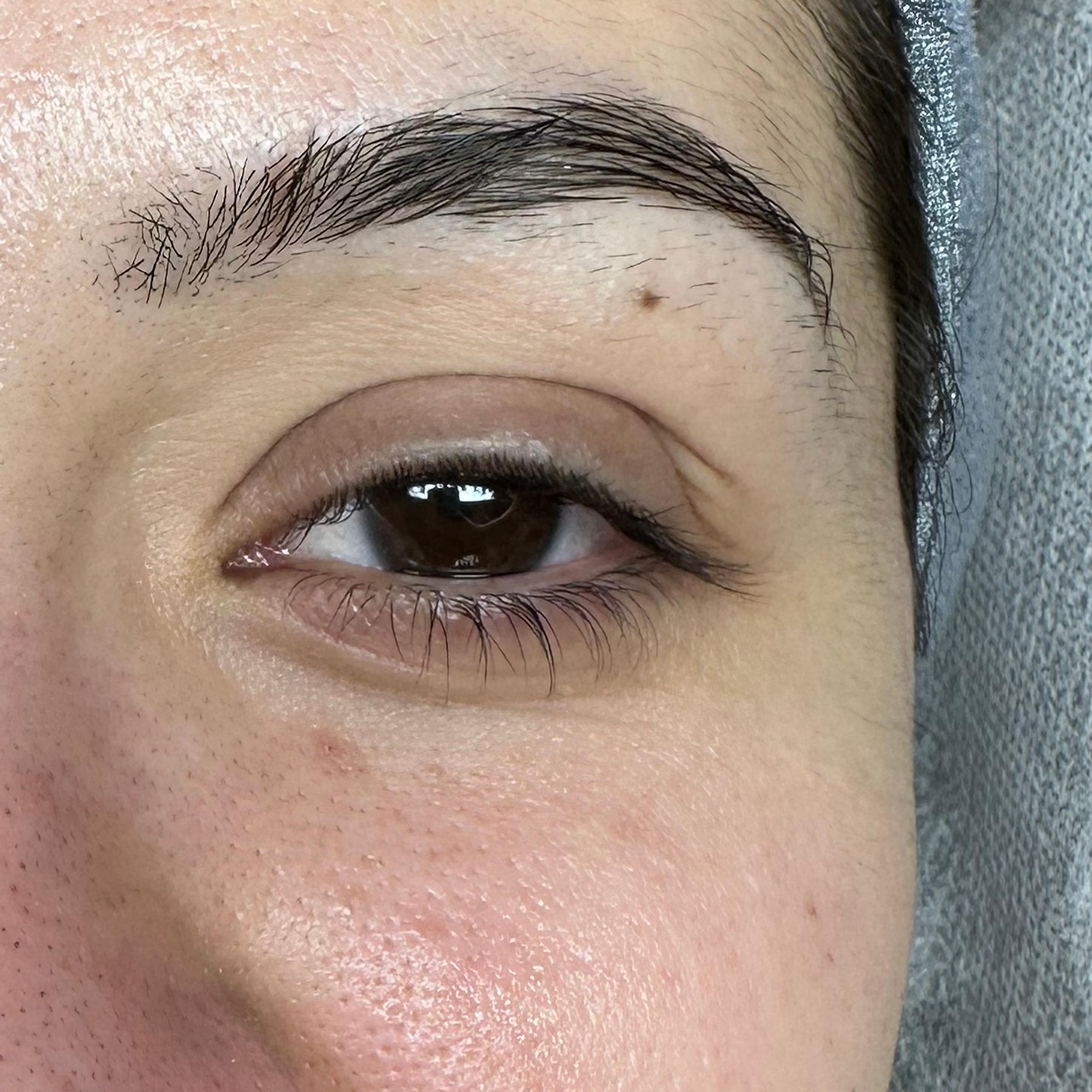 Right eye with straight, downward-pointing lashes before treatment.