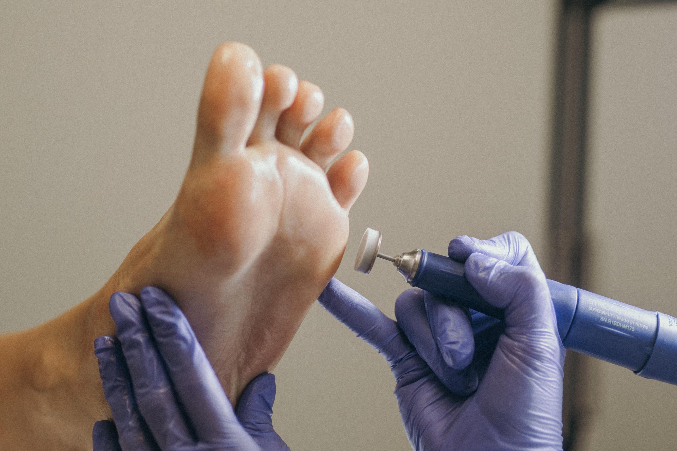 Gloved hands performing foot care with an electric file.