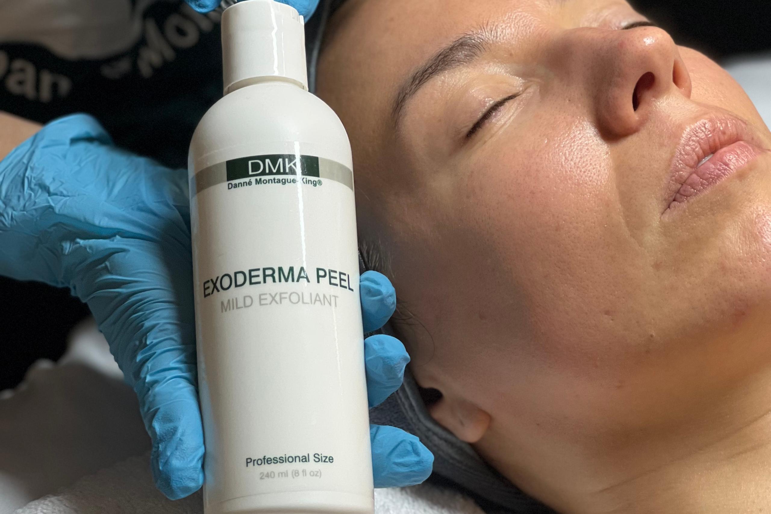 Gloved hands hold a DMK Exoderma Peel bottle next to a woman's face