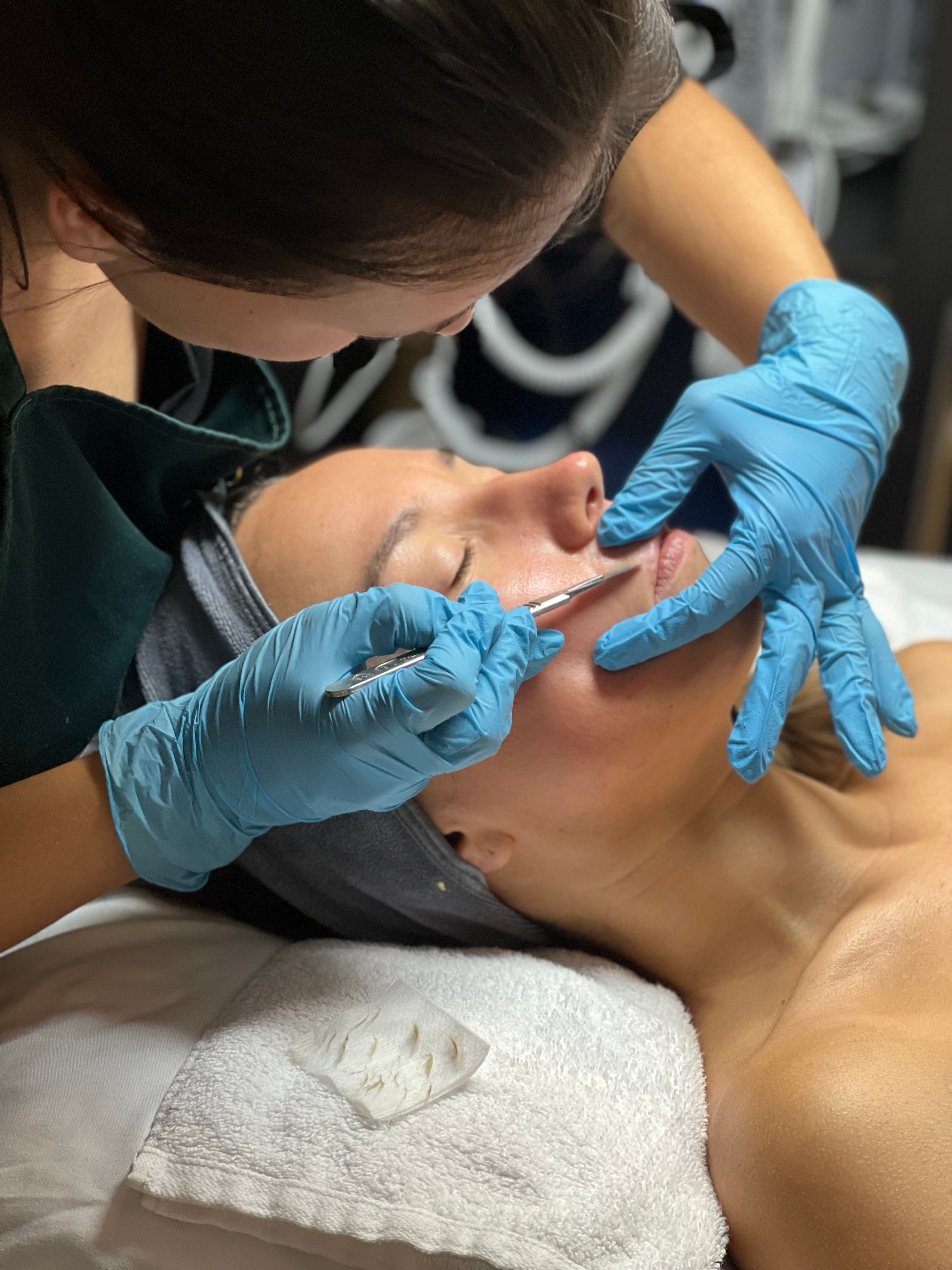 An esthetician in blue gloves uses a scalpel to perform a dermaplaning on a client.