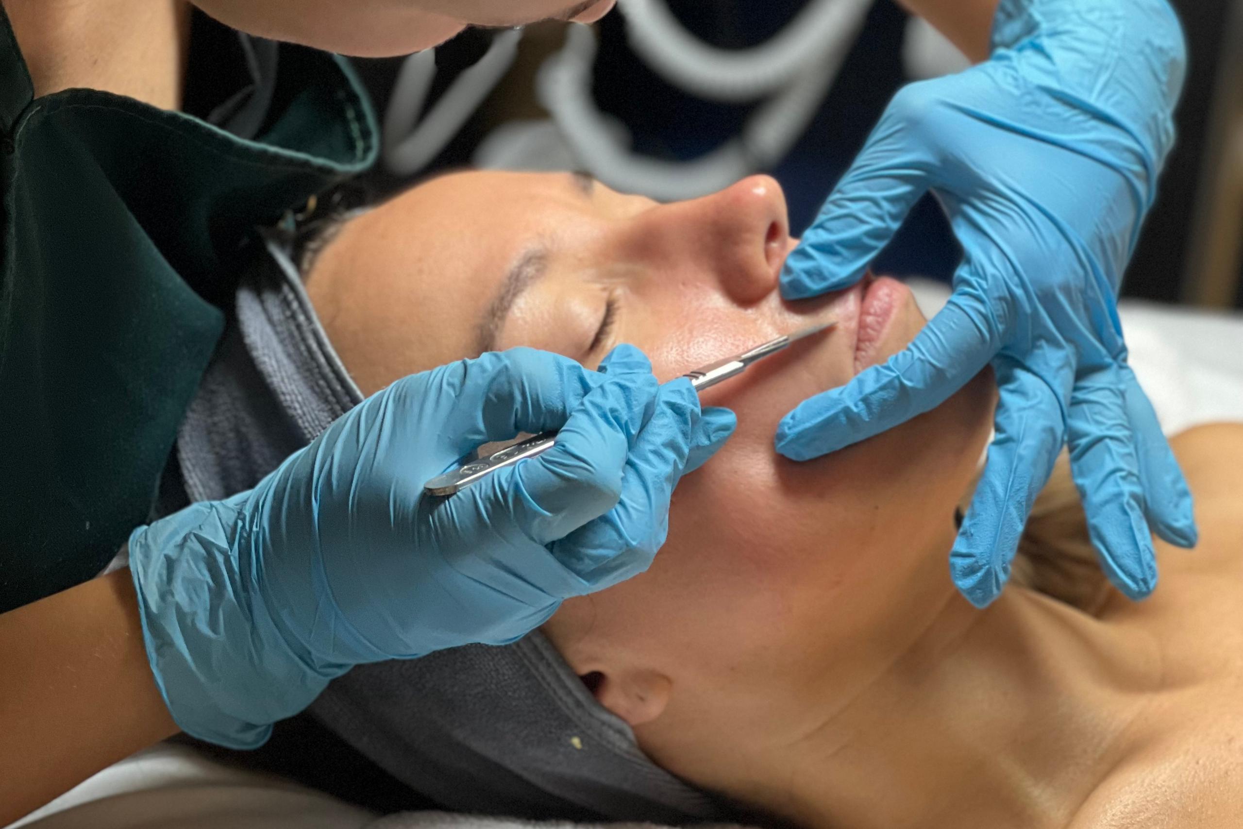 An esthetician in blue gloves uses a scalpel to perform a dermaplaning on a client.