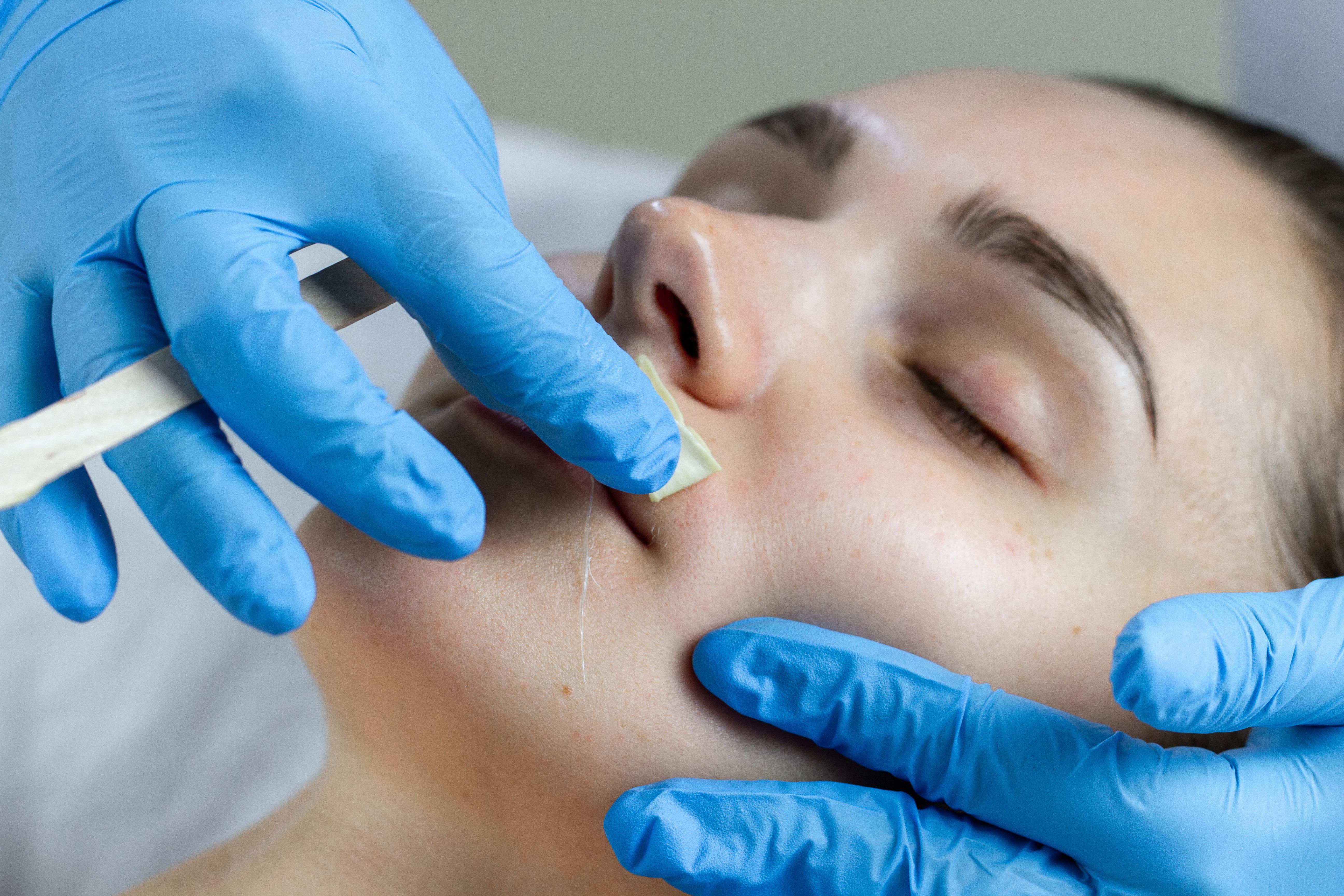 Woman getting upper lip waxed by gloved hands.