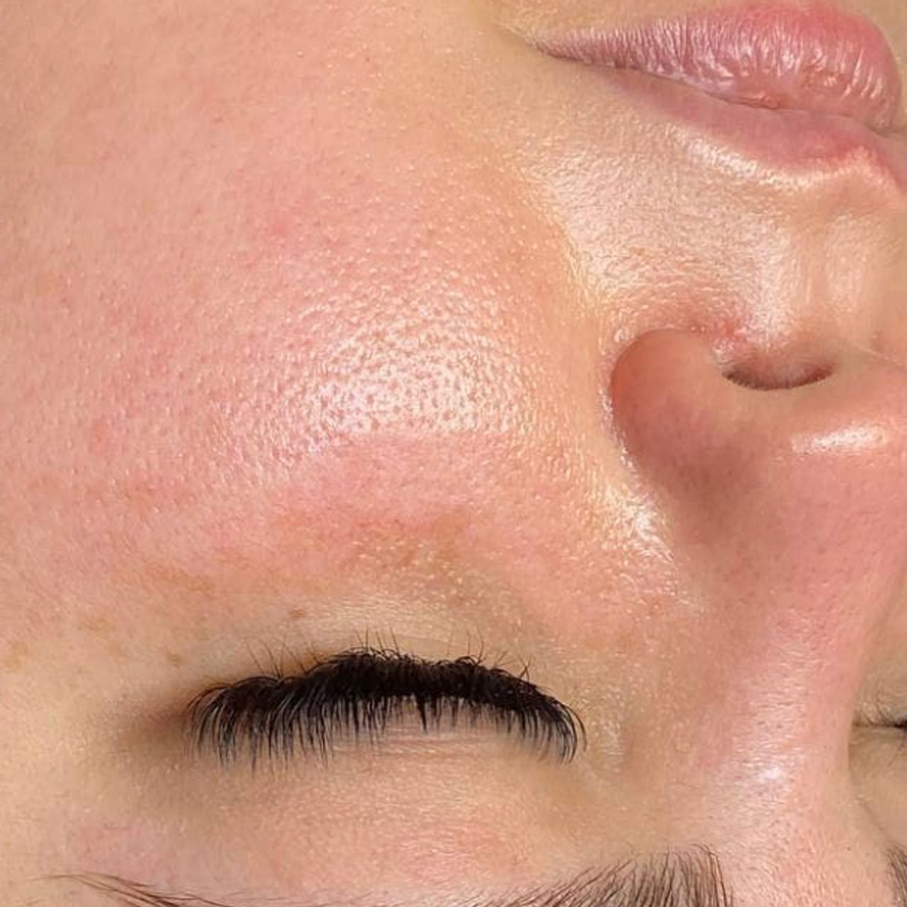 Close-up of a person's face with eyes closed, showing bright and dewy skin.