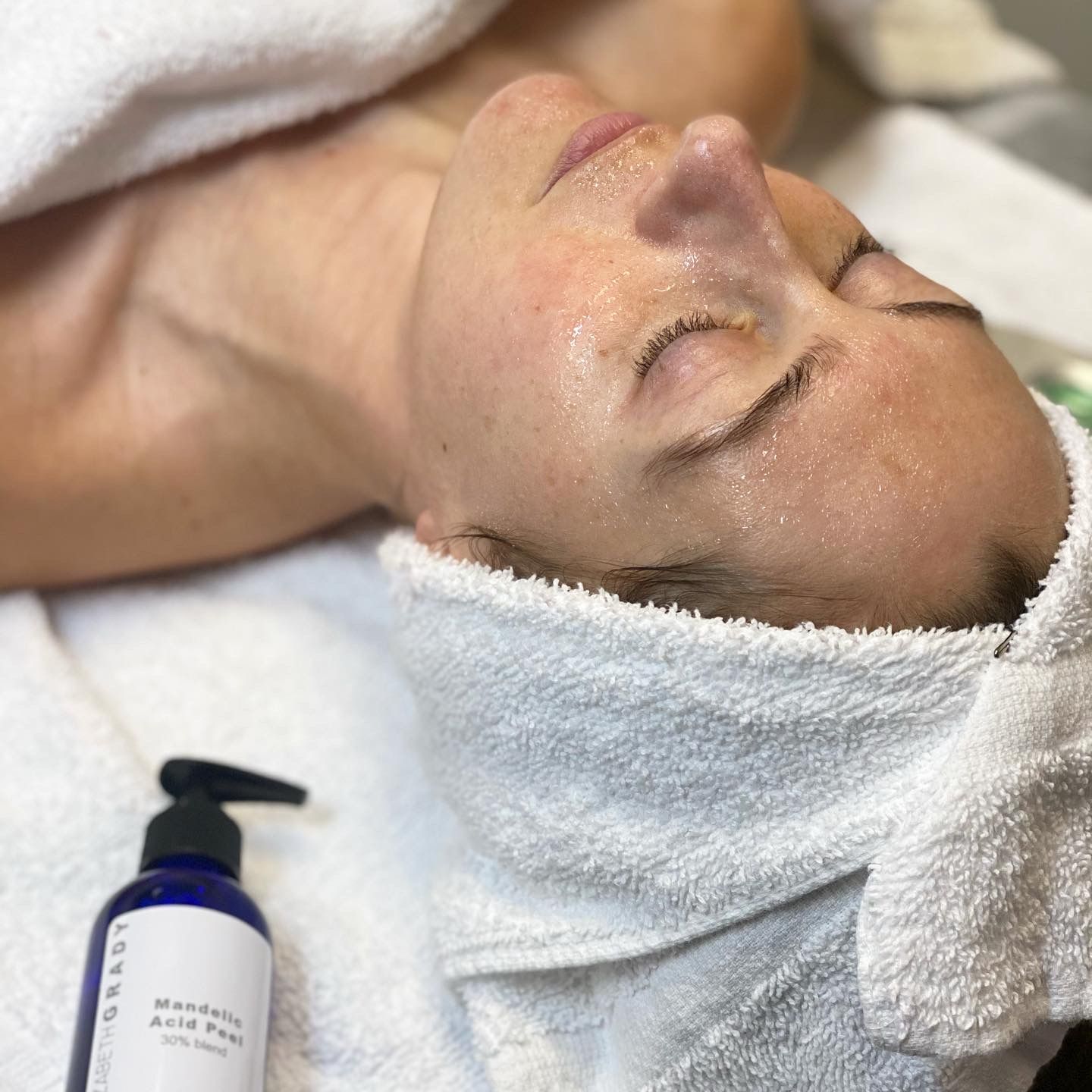 A person with closed eyes and a hair towel a Mandelic Acid Peel bottle in the foreground.