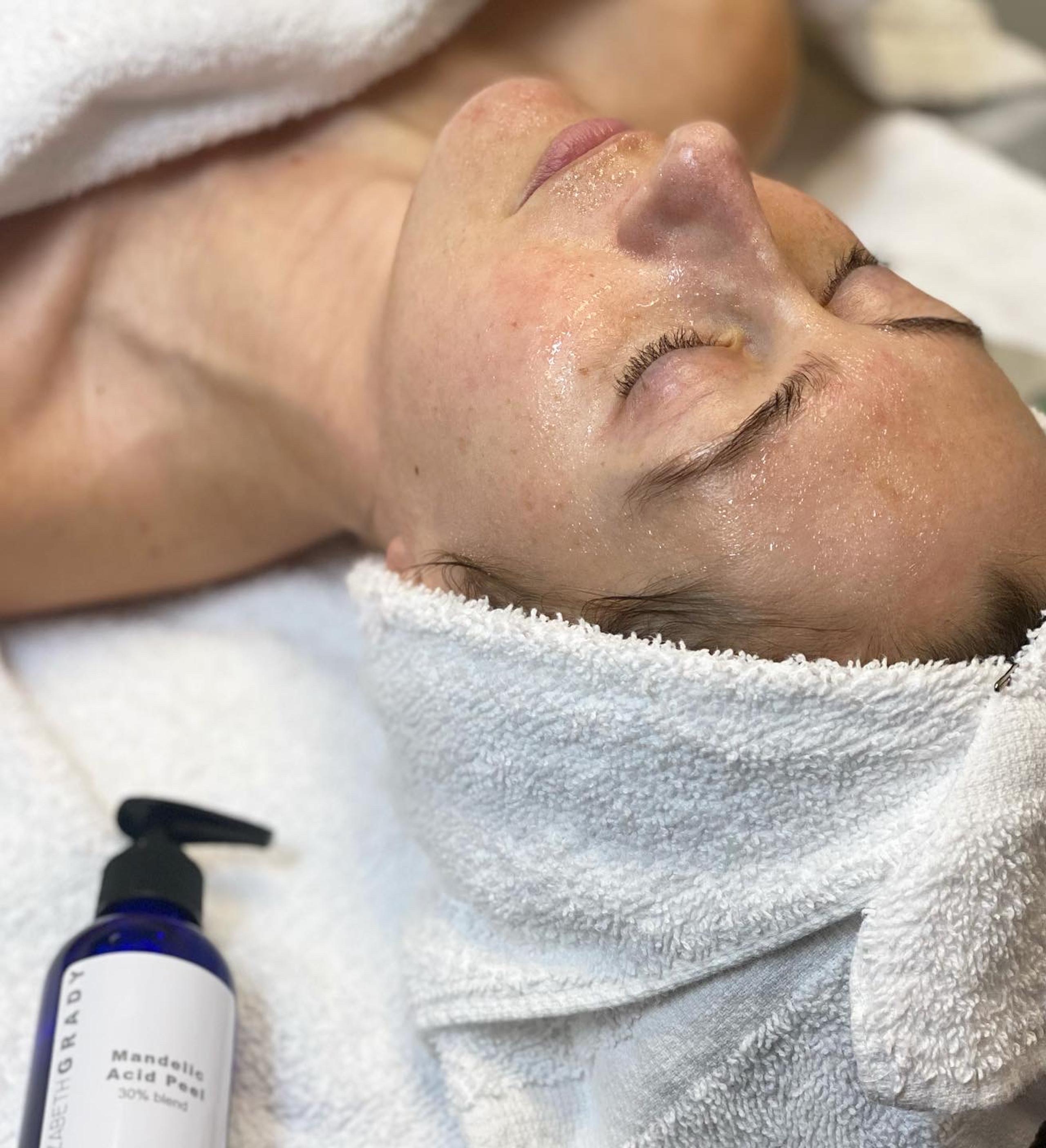 A person with closed eyes and a hair towel a Mandelic Acid Peel bottle in the foreground.