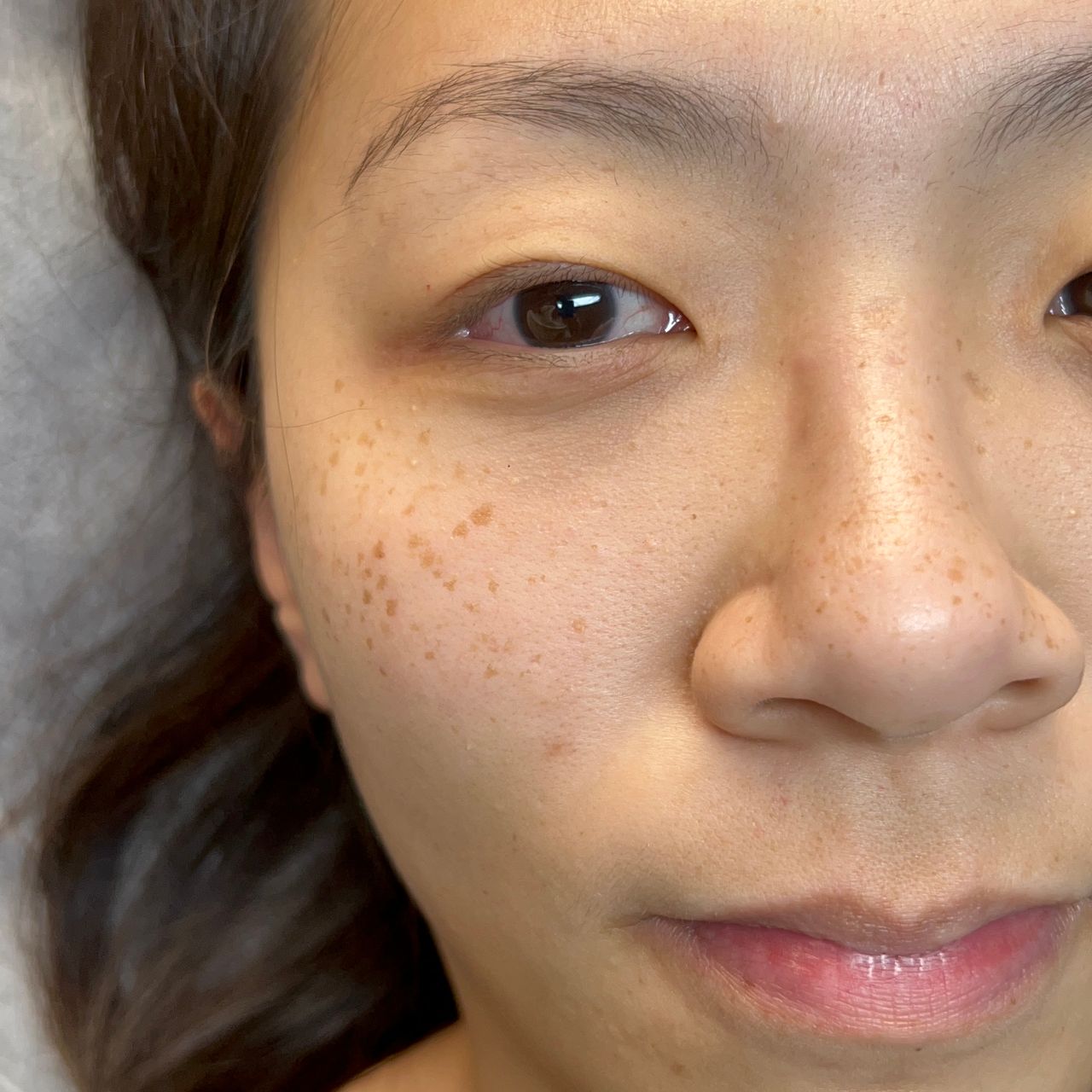 Close-up of a person's face with fair skin and numerous freckles on the cheeks and nose, brown eyes, and dark hair.
