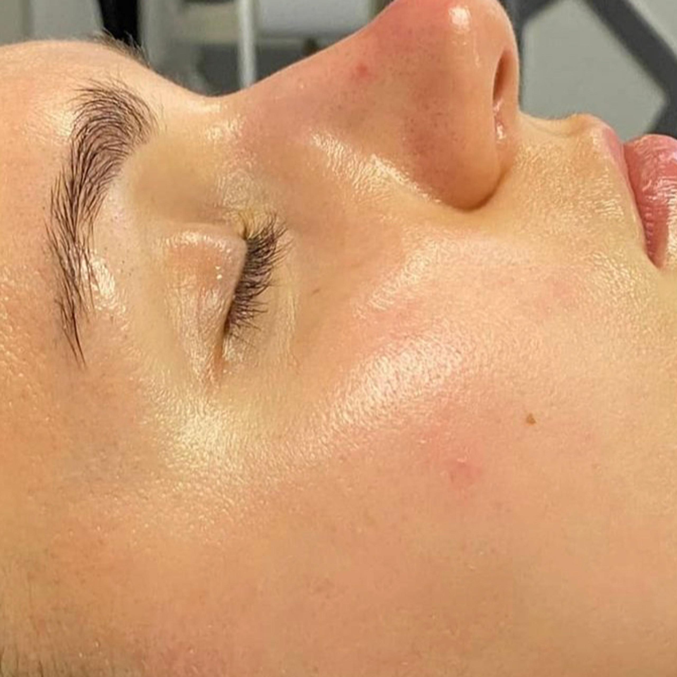 A person's face in profile with smooth, dewy skin and closed eyes