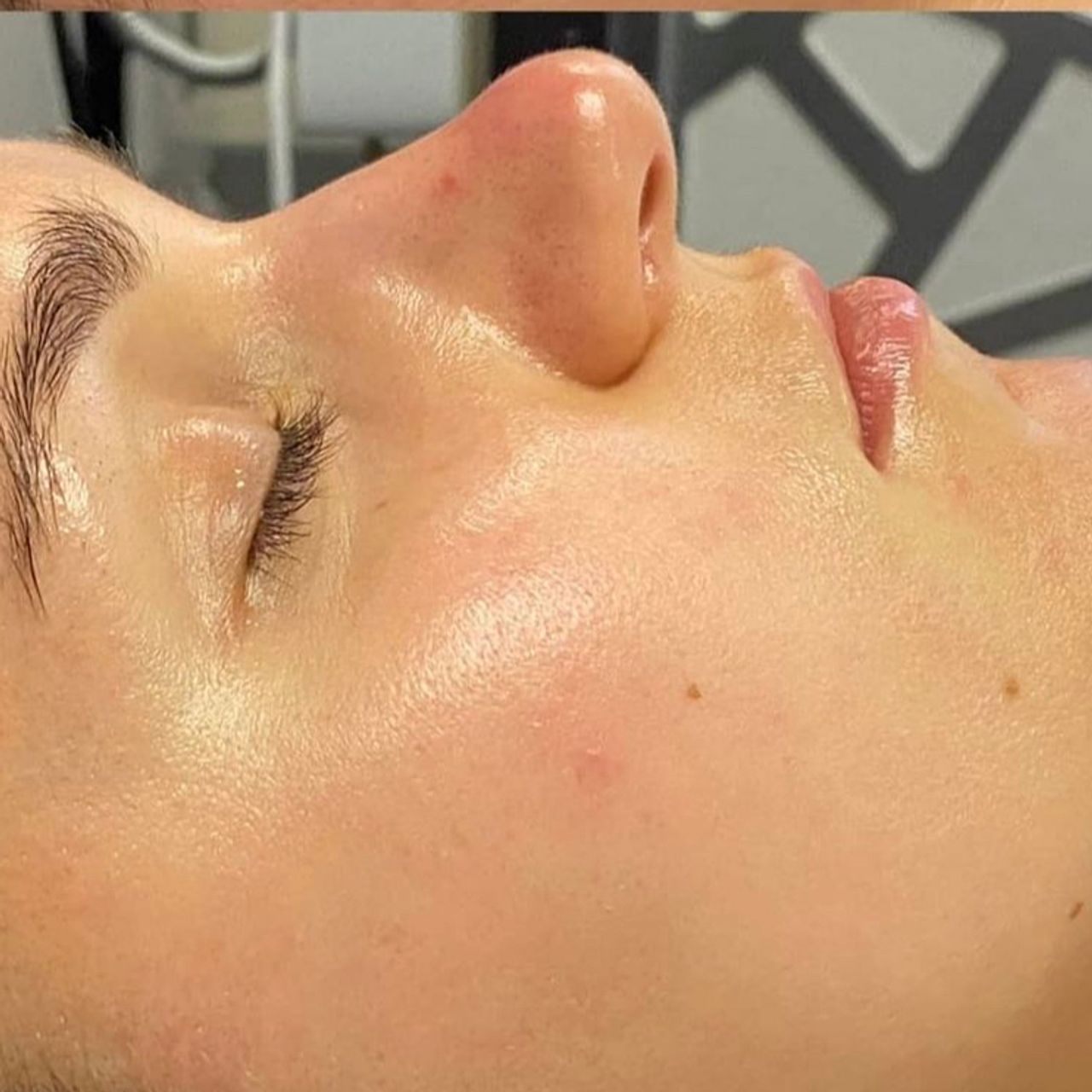 A person's face in profile with smooth, dewy skin and closed eyes