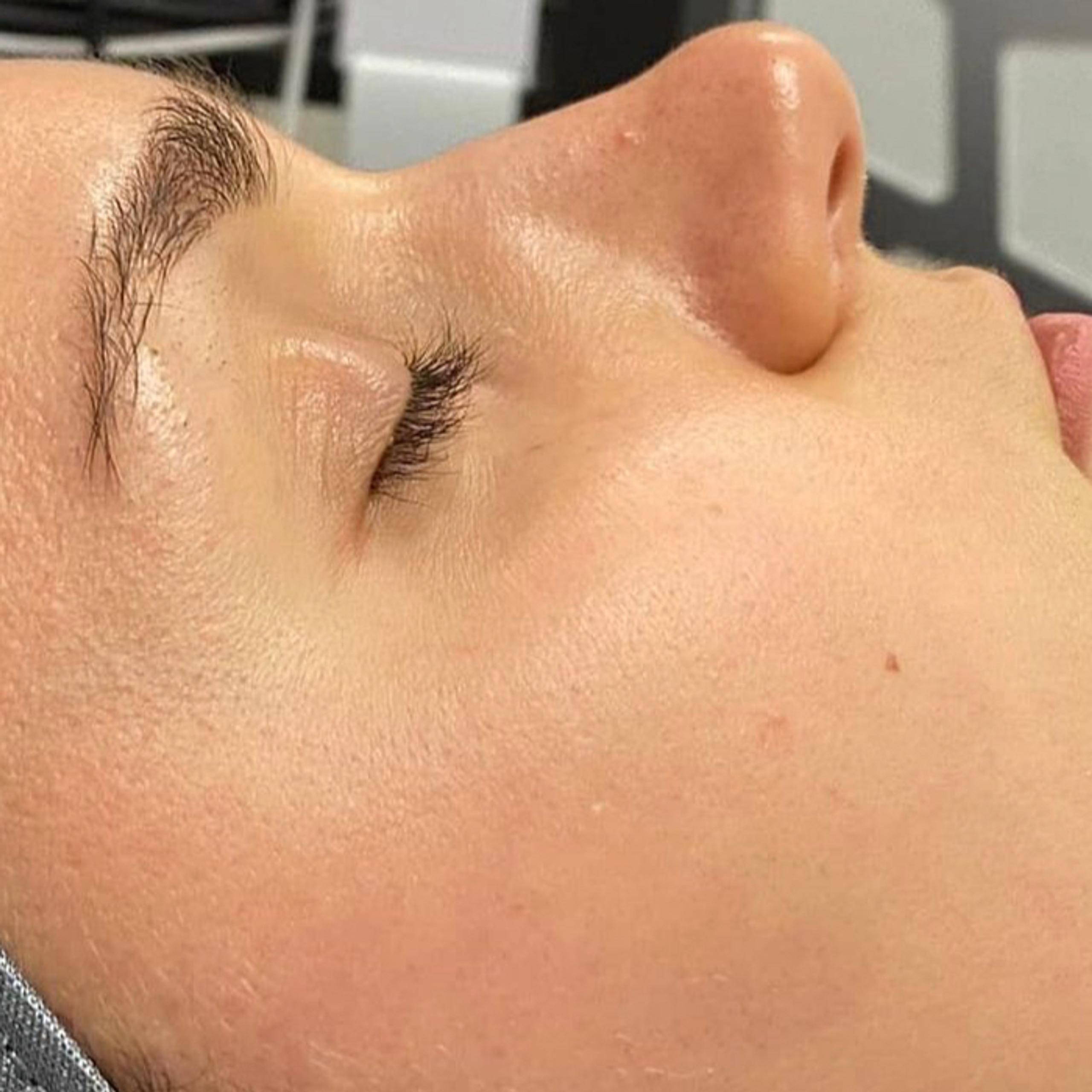 Profile view of a person with closed eyes, showing clean skin