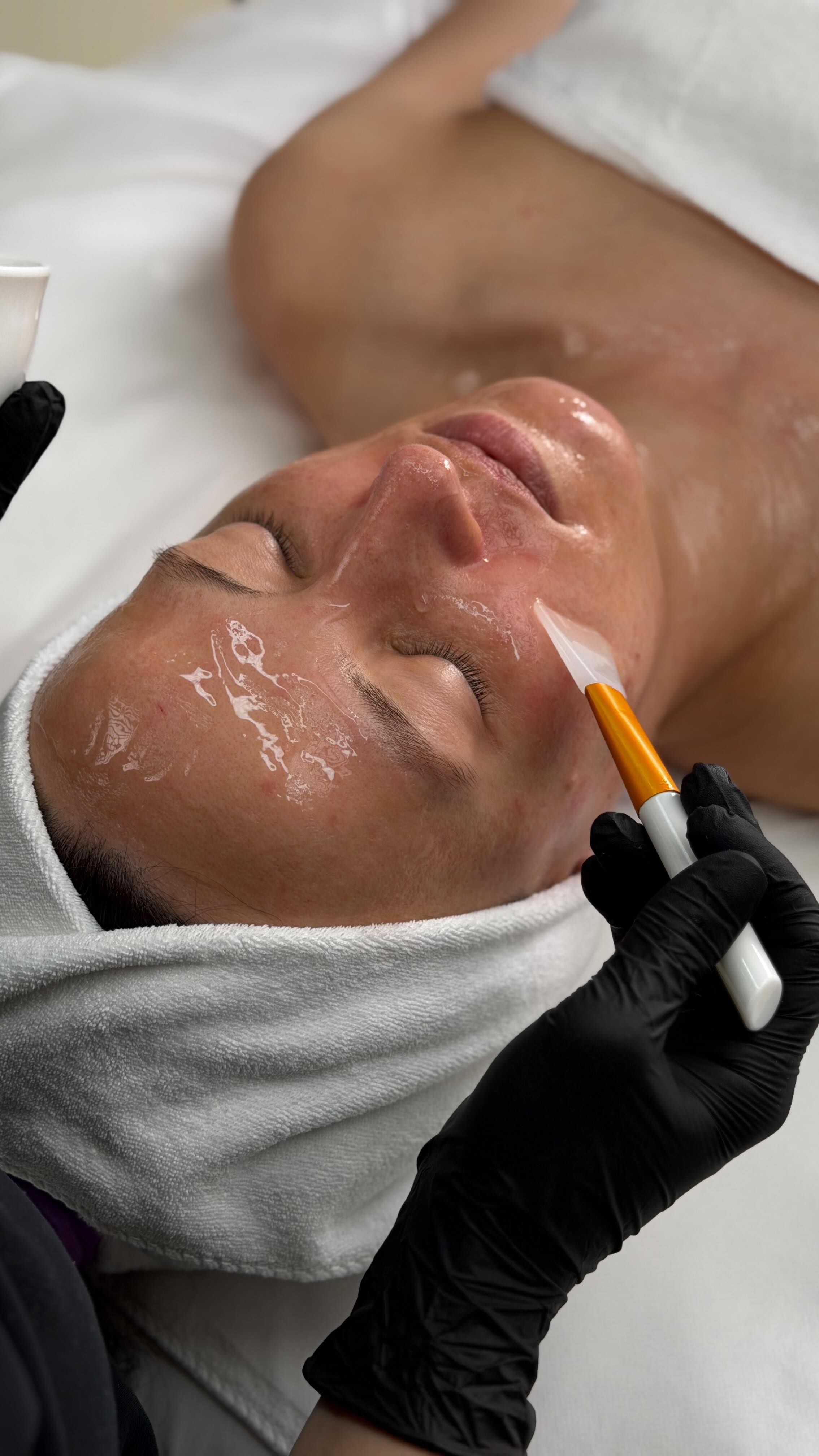 A gloved hand uses a plastic mask brush to apply a clear mask to woman's cheek