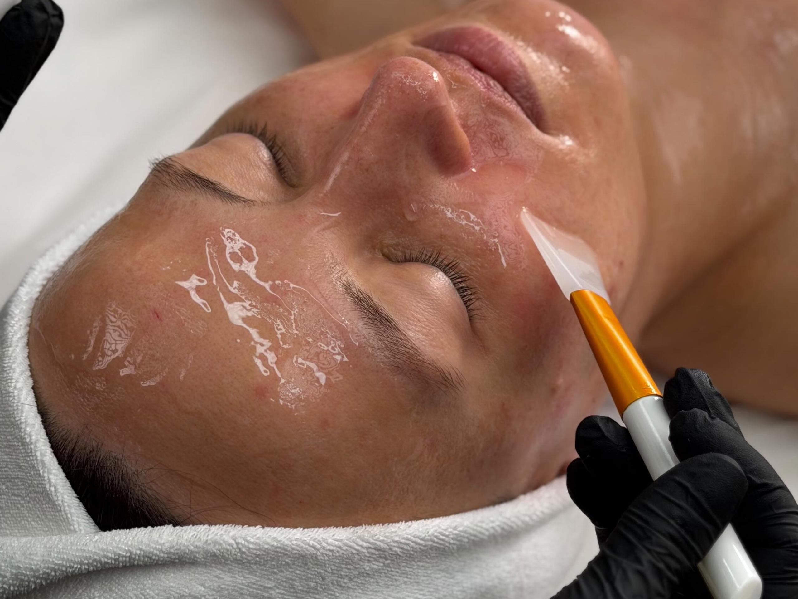 A gloved hand uses a plastic mask brush to apply a clear mask to woman's cheek