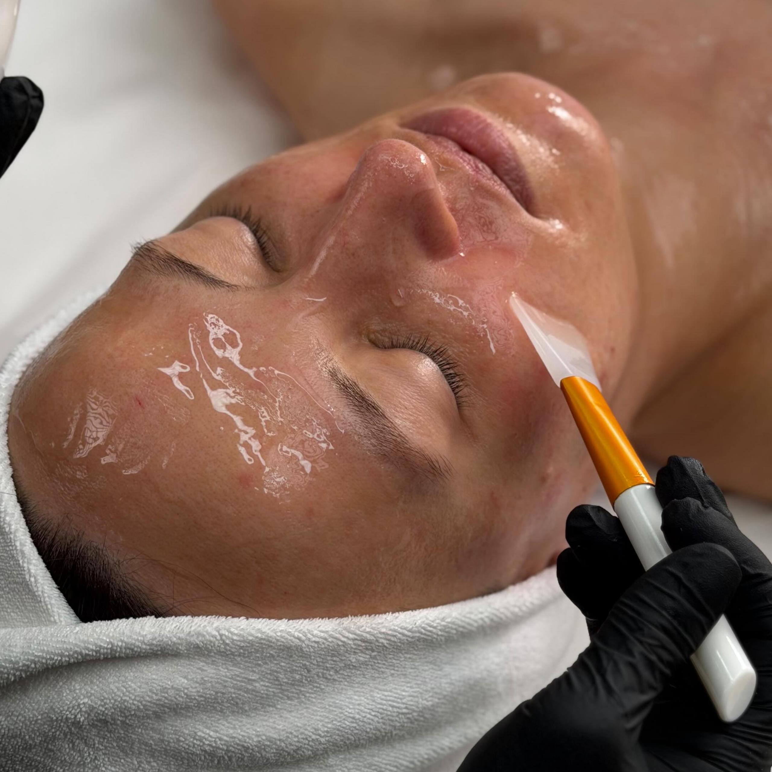 A gloved hand uses a plastic mask brush to apply a clear mask to woman's cheek