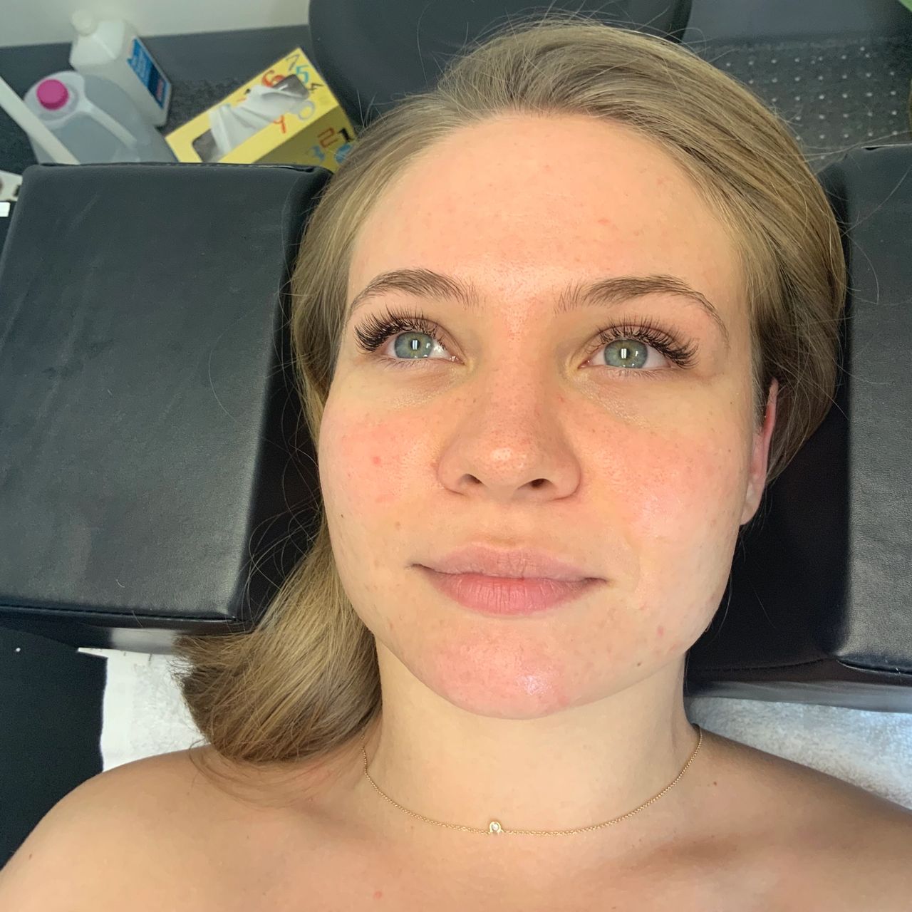 Client lying on treatment bed looking upward after classic lash extensions application