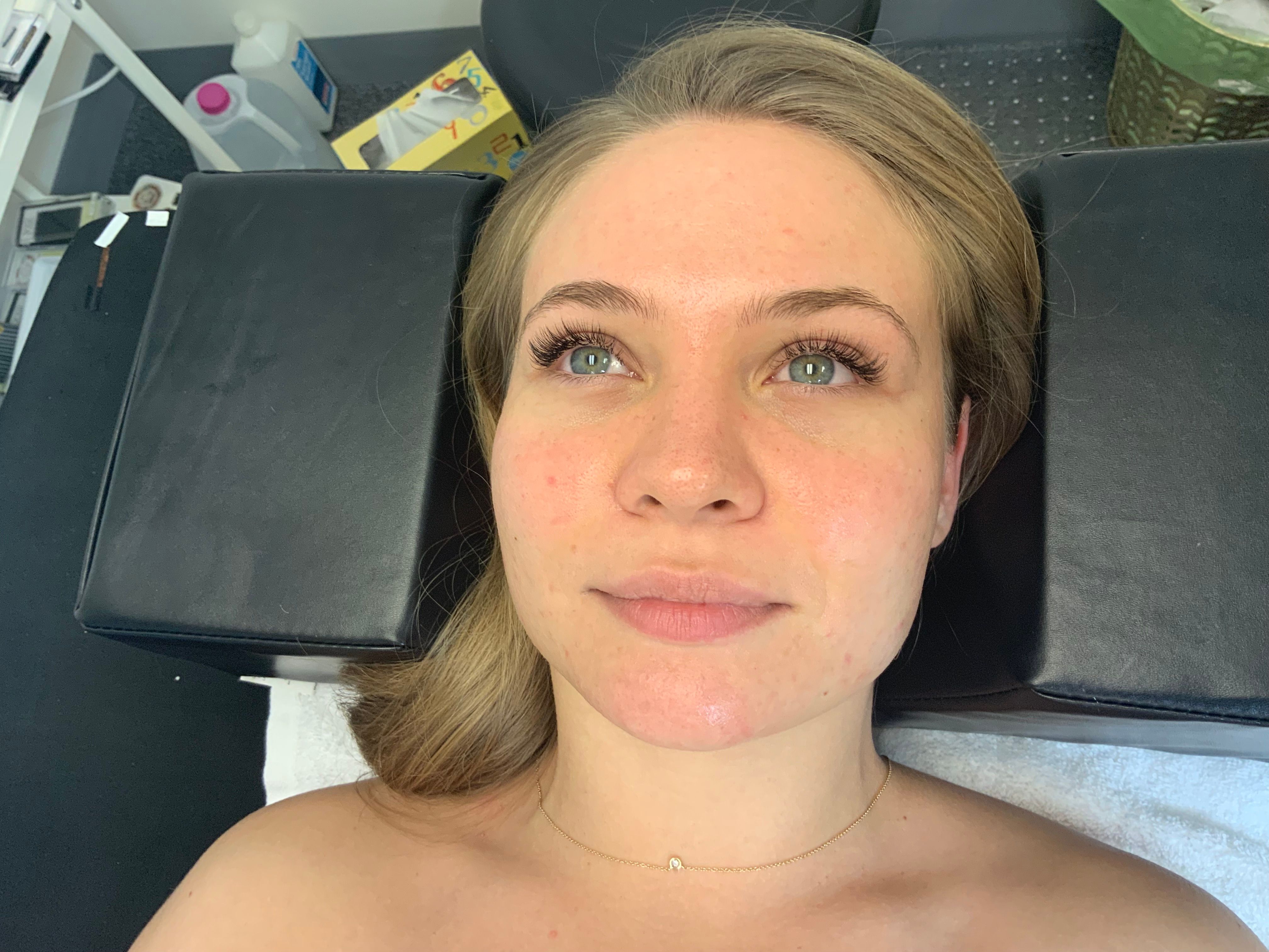 Client resting on a treatment bed after classic eyelash extensions
