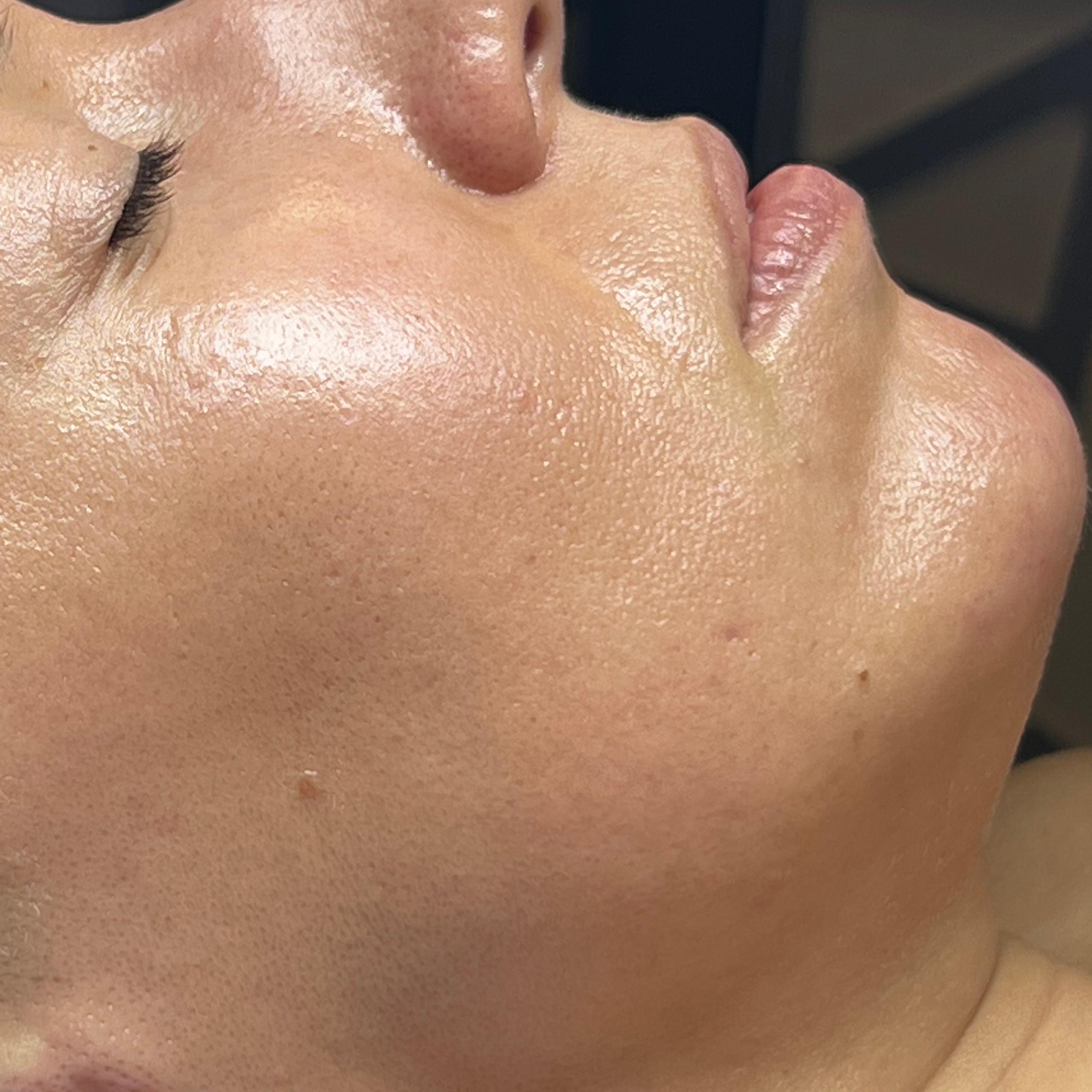 Close-up side profile of a person's face with dewy skin.