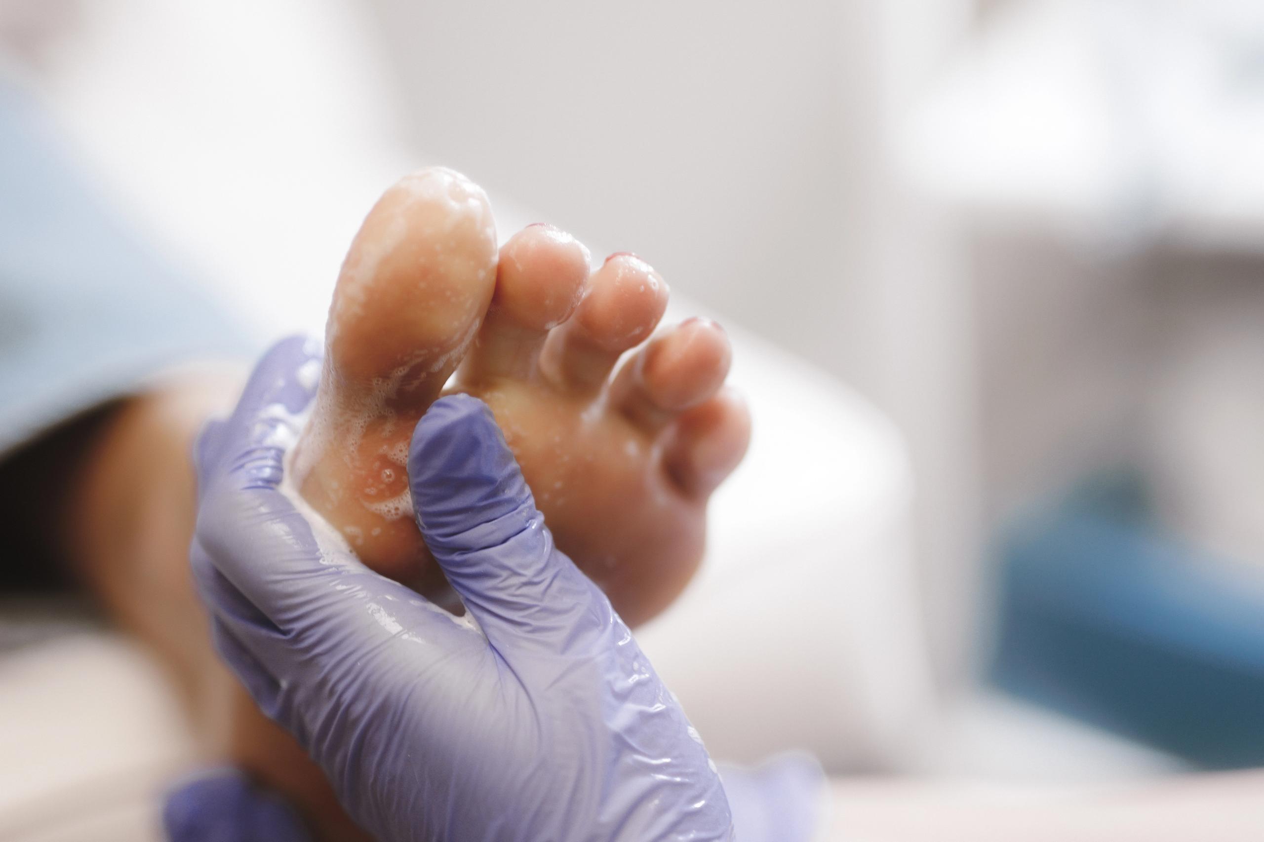 A gloved hand scrubbing a foot with a foamy product.