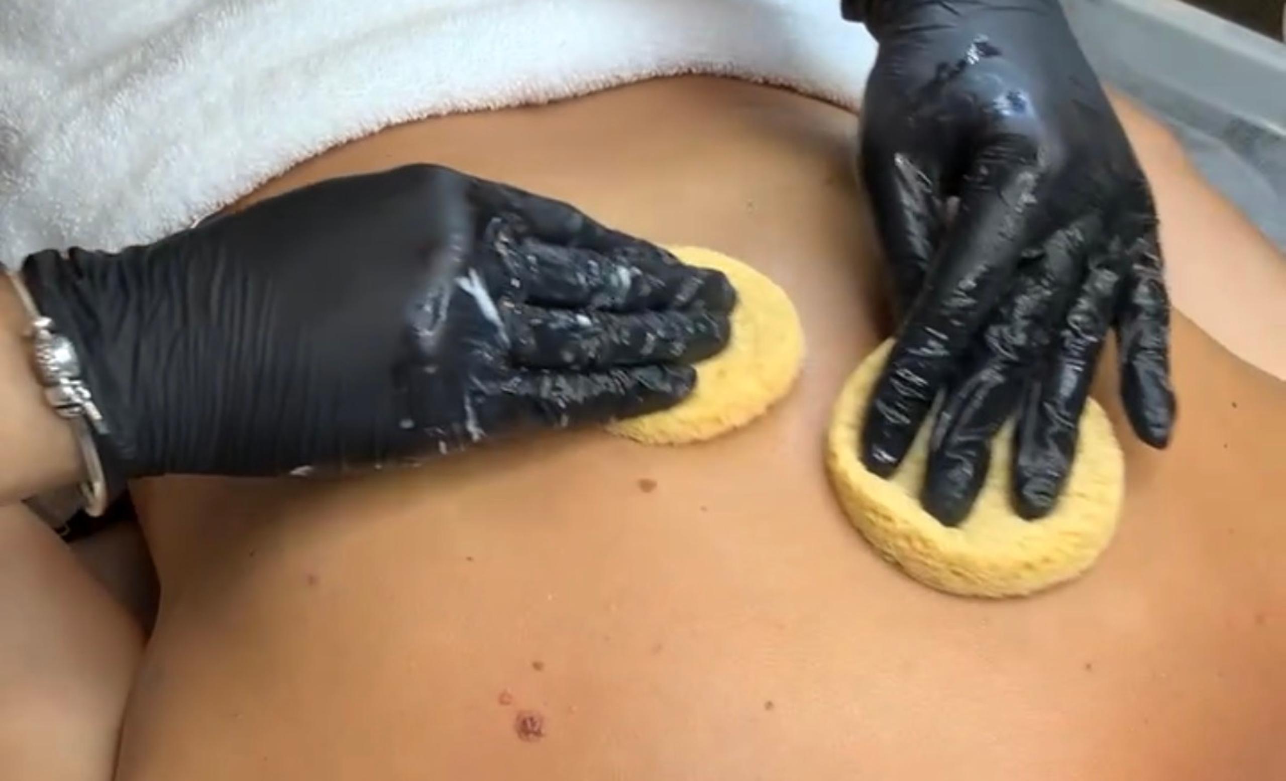 Two gloved hands using yellow sponges to clean a person's back.