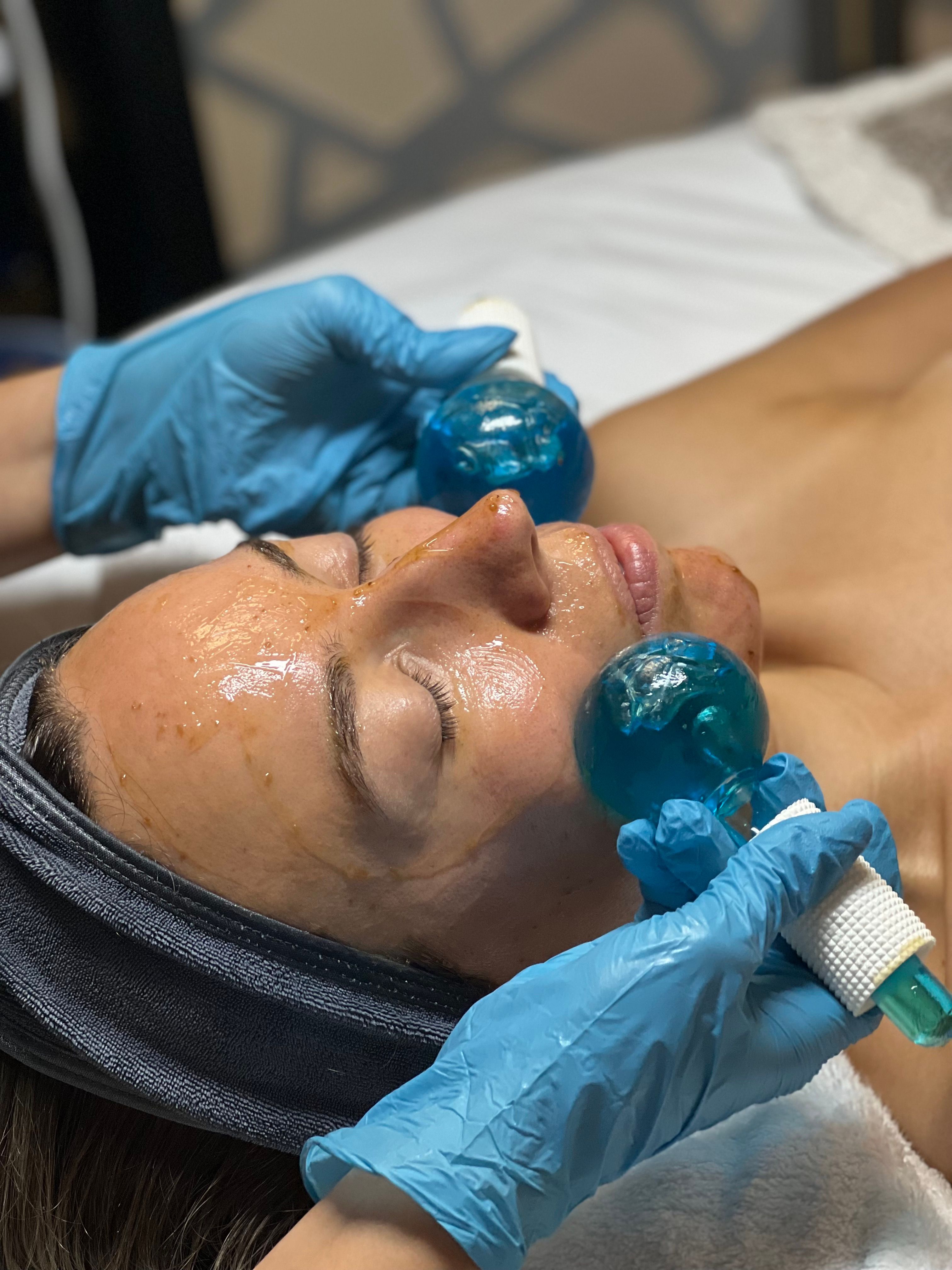 A person receives a facial treatment with two blue ice globes applied to their face by gloved hands.