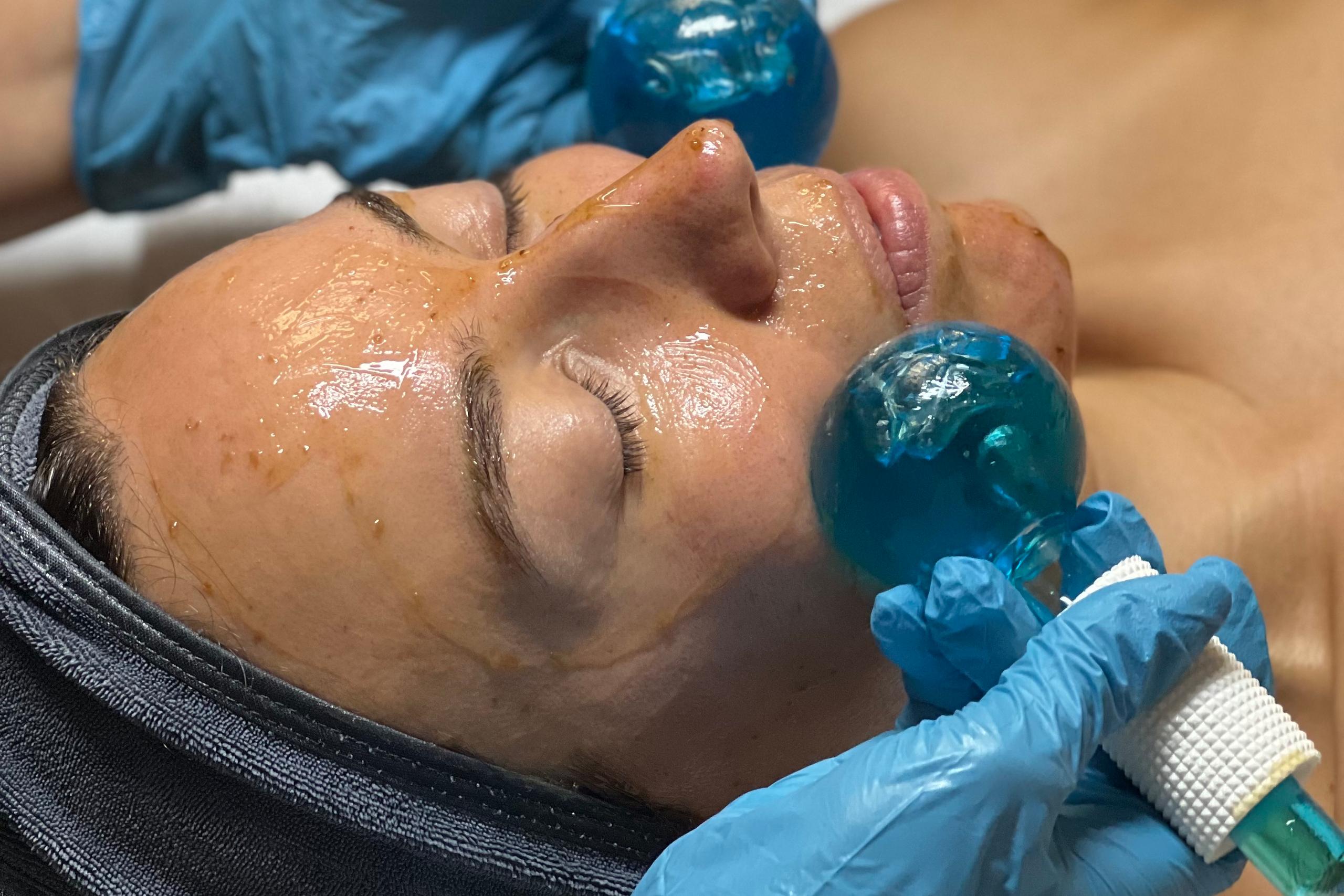 A person receives a facial treatment with two blue ice globes applied to their face by gloved hands.