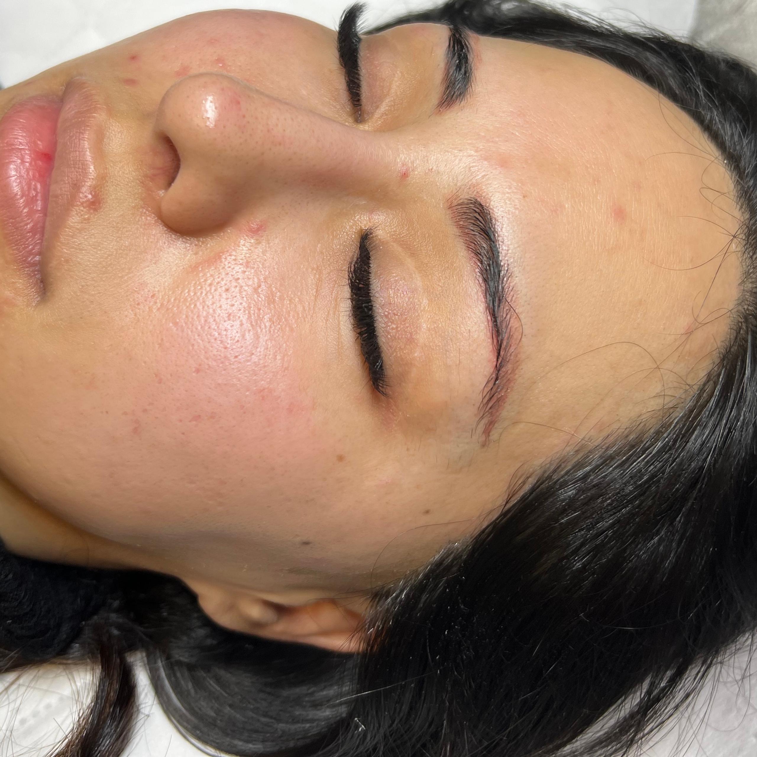 A person with closed eyes showing clear, bright and slightly red skin