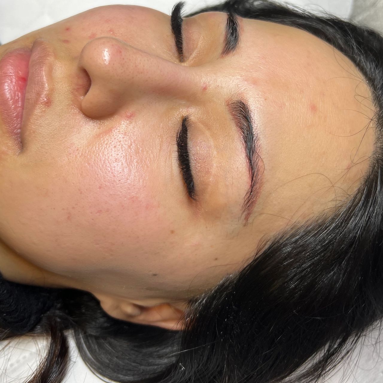 A person with closed eyes showing clear, bright and slightly red skin