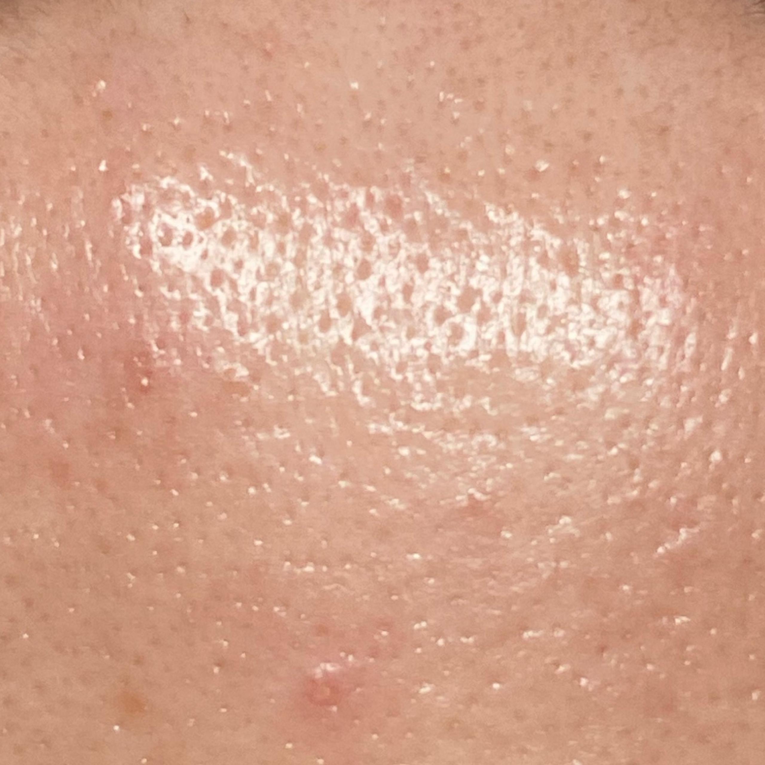 Close-up of a forehead showing visible clear pores and bright skin.