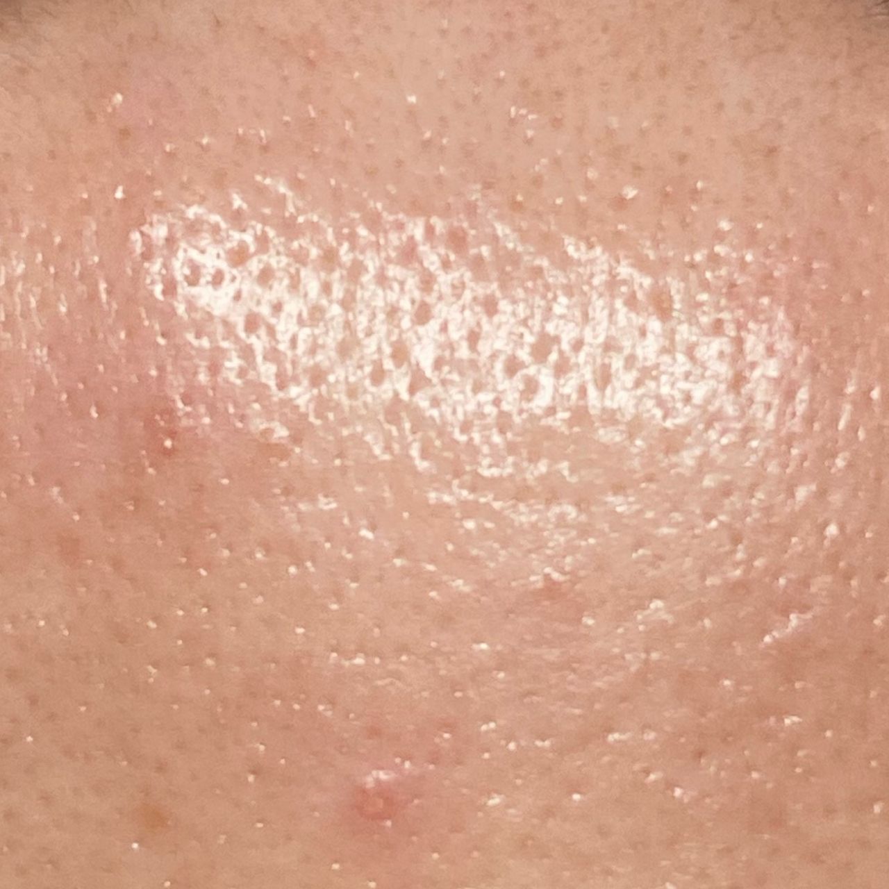 Close-up of a forehead showing visible clear pores and bright skin.