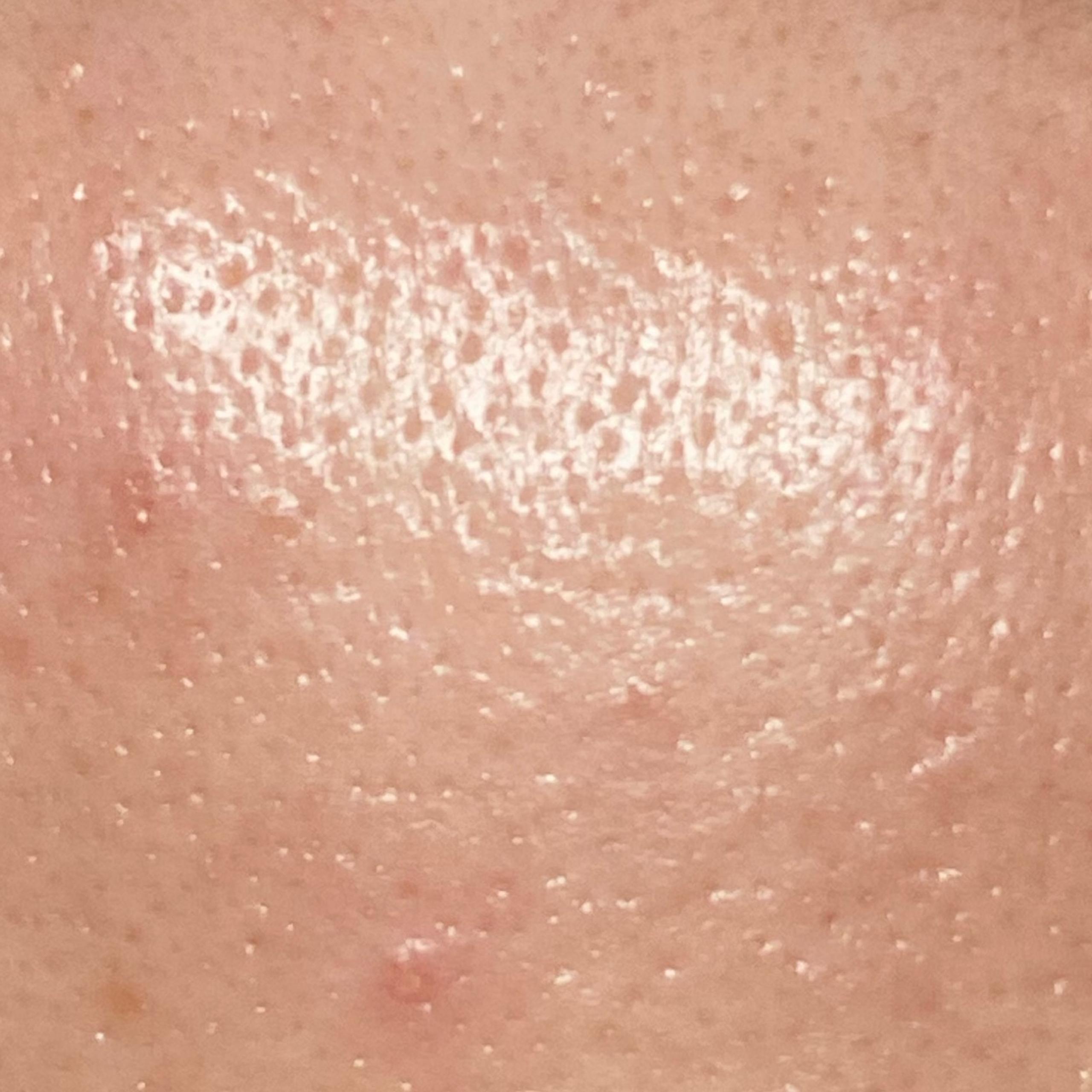 Close-up of a forehead showing visible clear pores and bright skin.