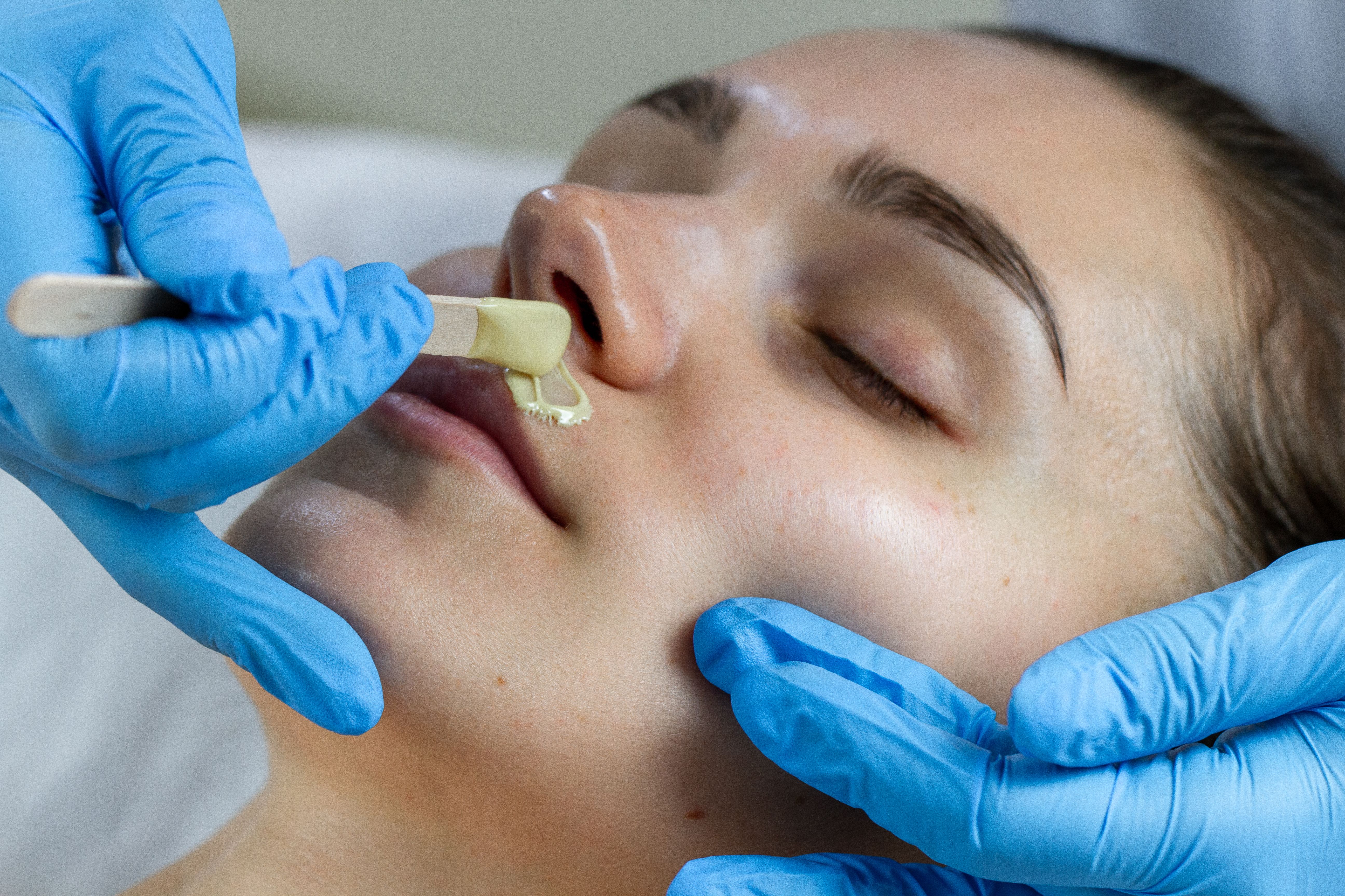 Close-up of a person receiving an upper lip wax from a gloved hand.