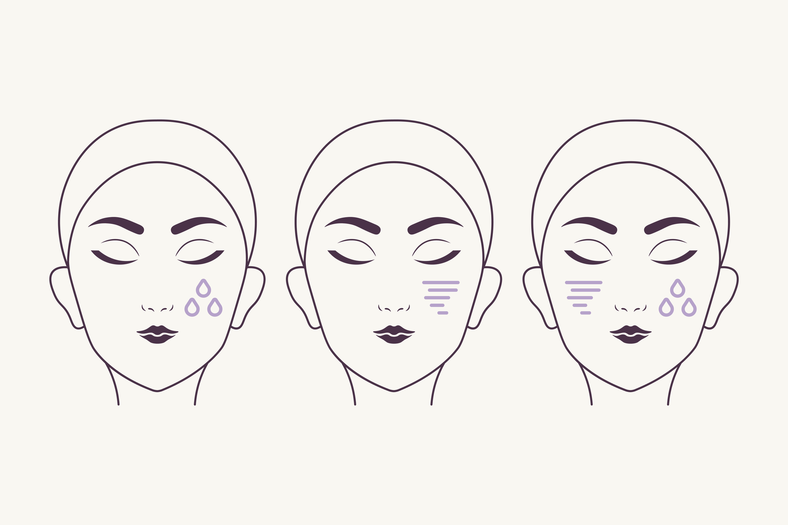 Line art of three faces showing skincare concerns: hydration (purple droplets), wrinkles (purple lines), and a combination of both.