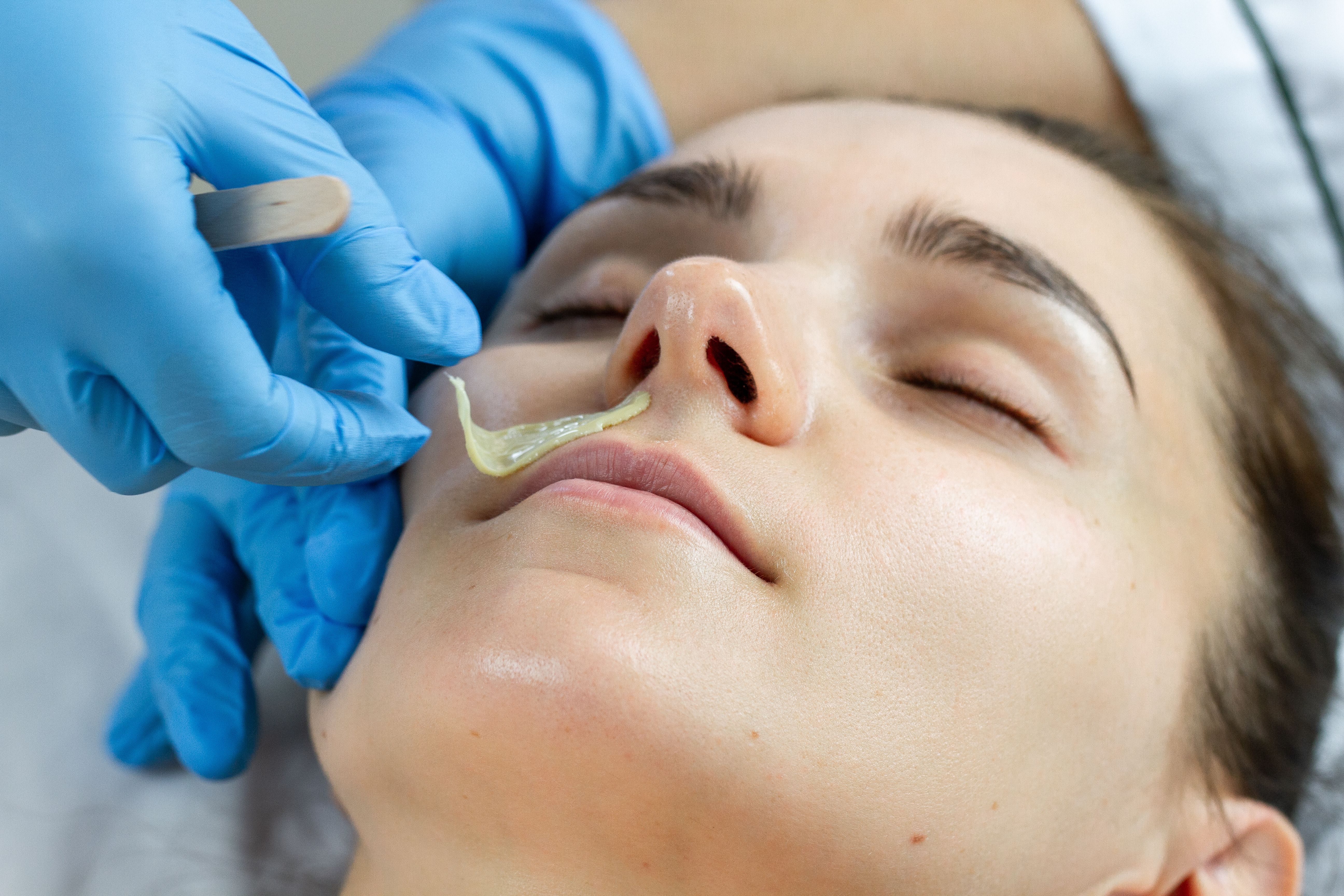 A gloved hand applies yellow wax to a person's upper lip.