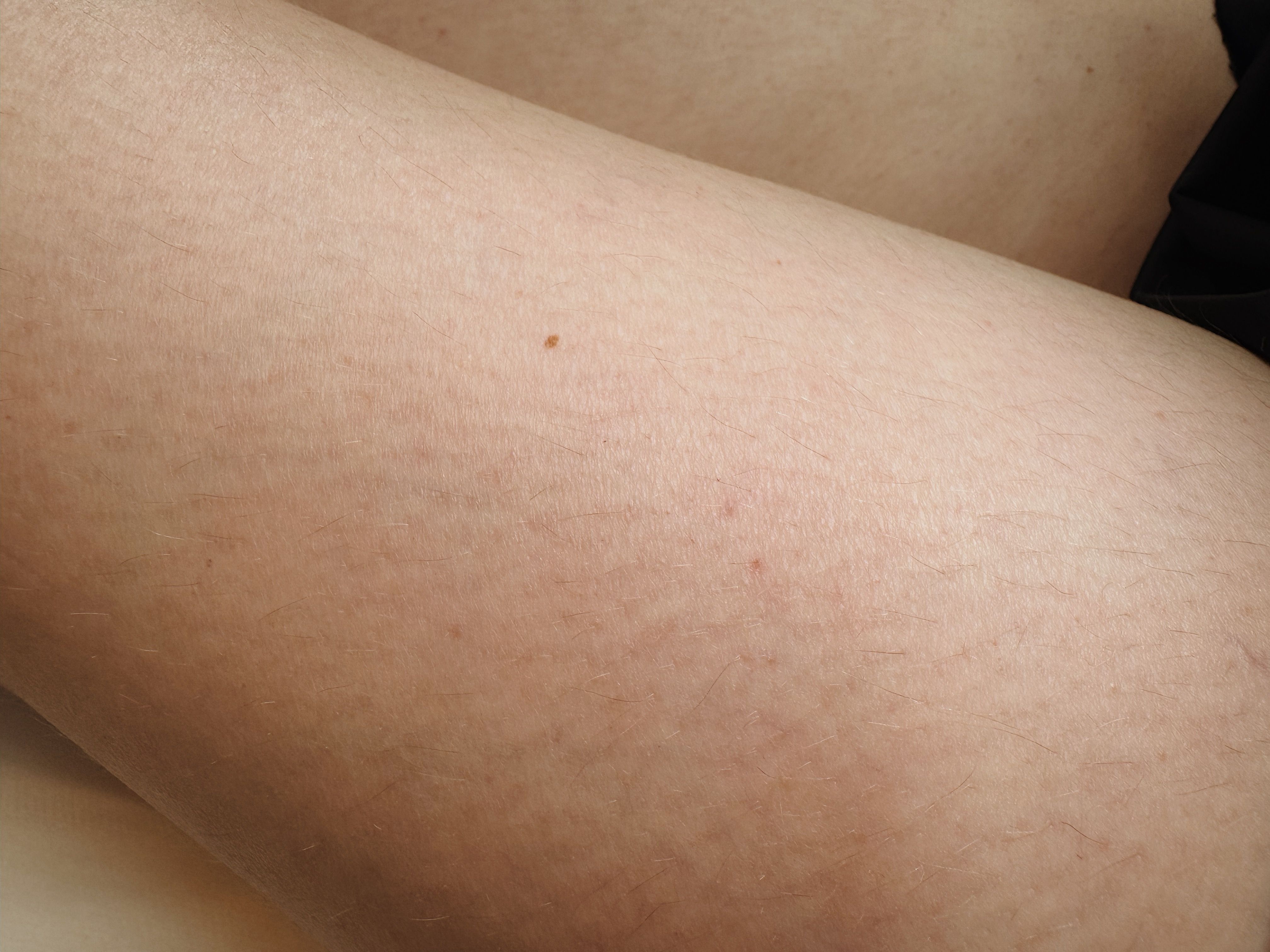 the upper part of a girl's leg