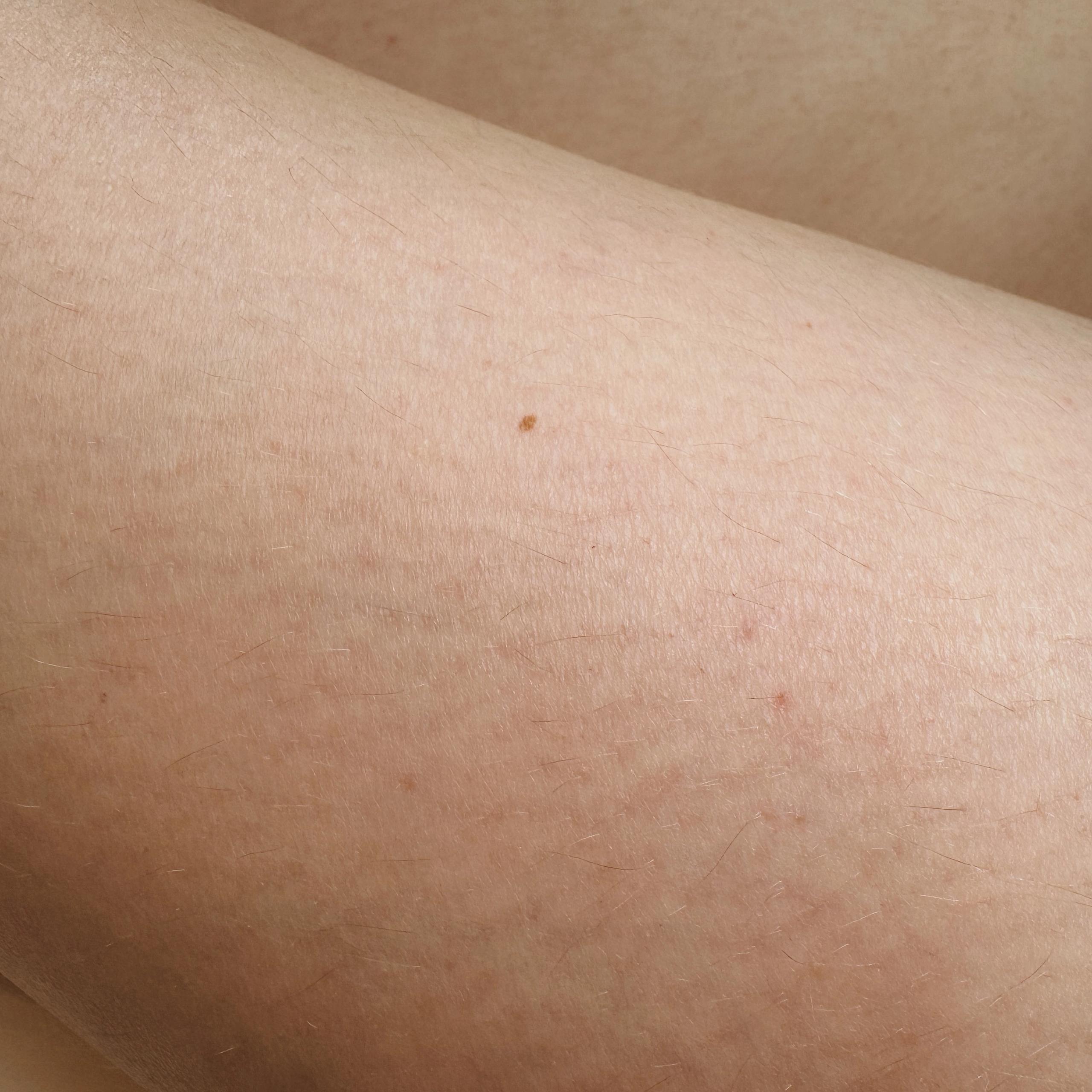 the upper part of a girl's leg