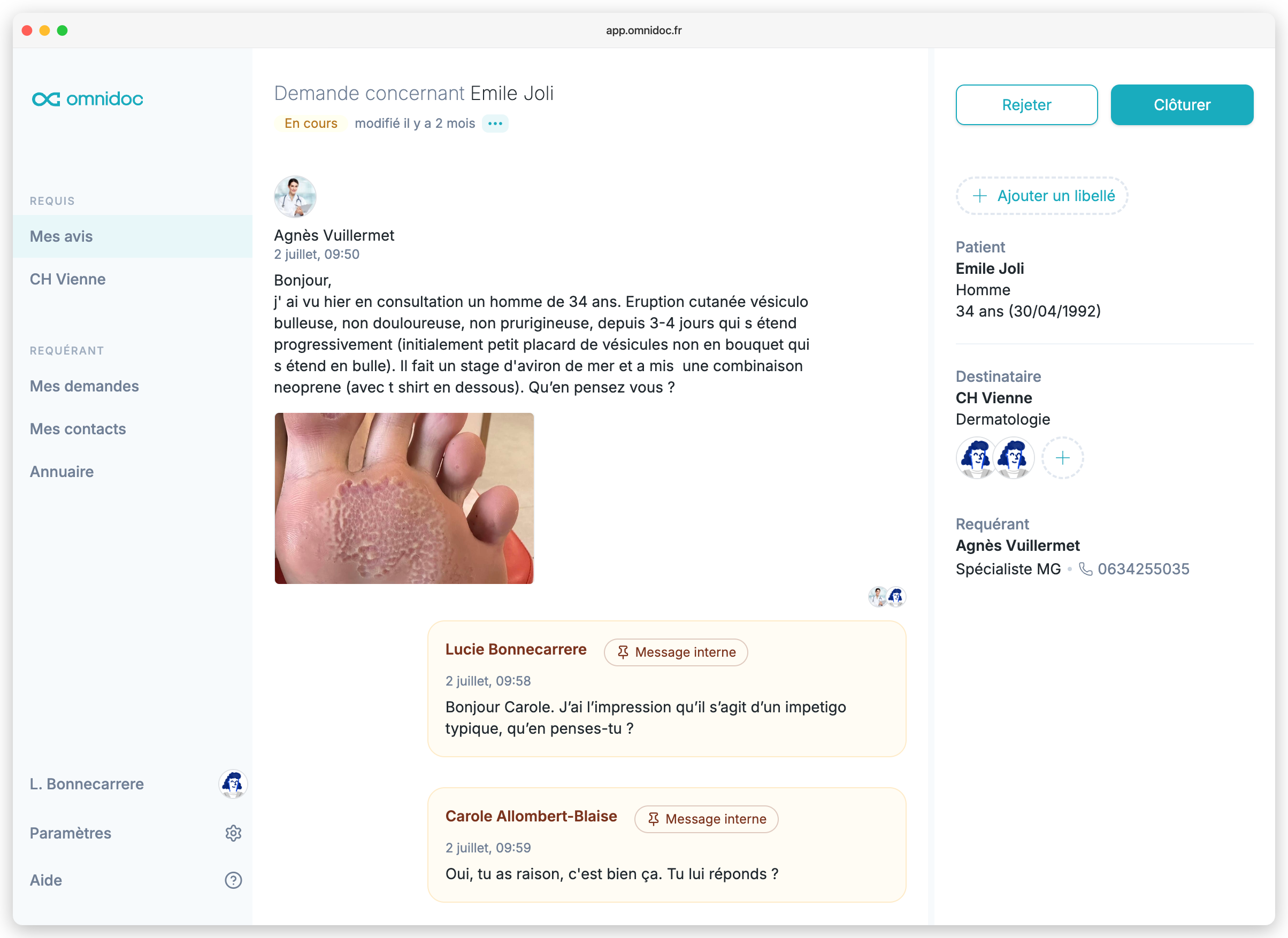 Téléexpertise