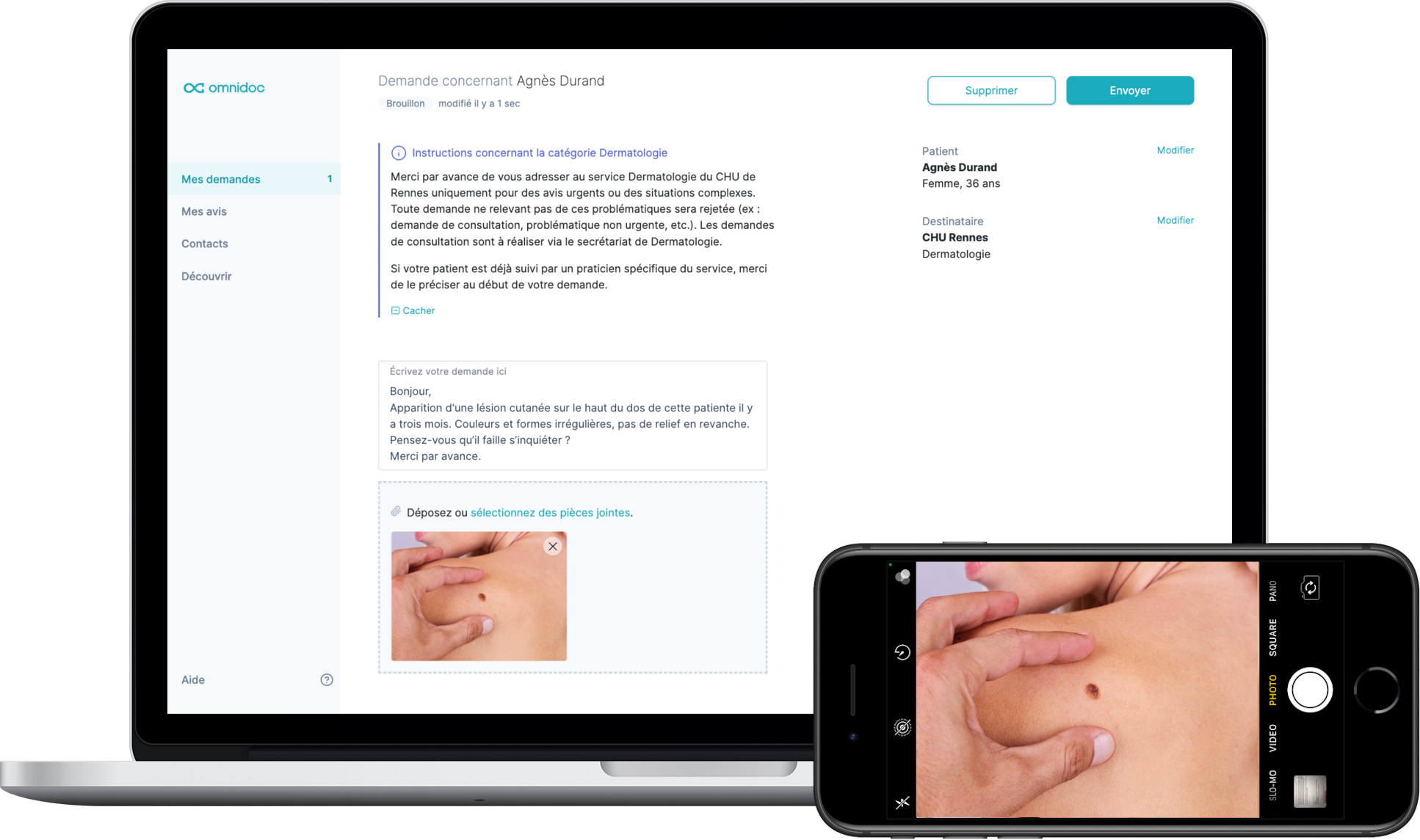 Réalisation d'actes de télé-expertise depuis ordinateur ou téléphone mobile