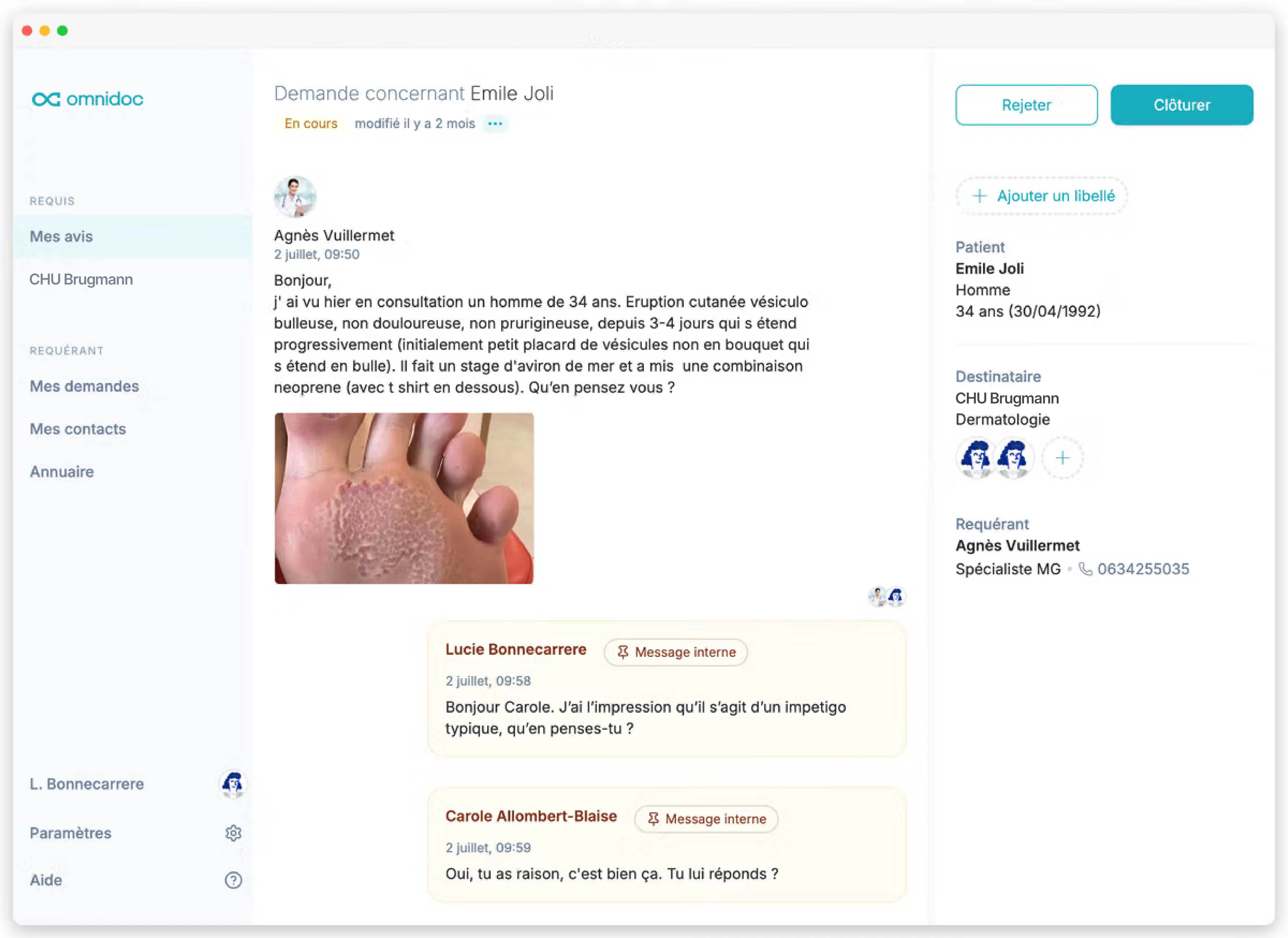 Demande de télé-expertise sur Omnidoc depuis ordinateur et smartphone