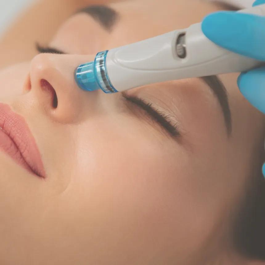 Limpieza Facial con Hydra.Pen