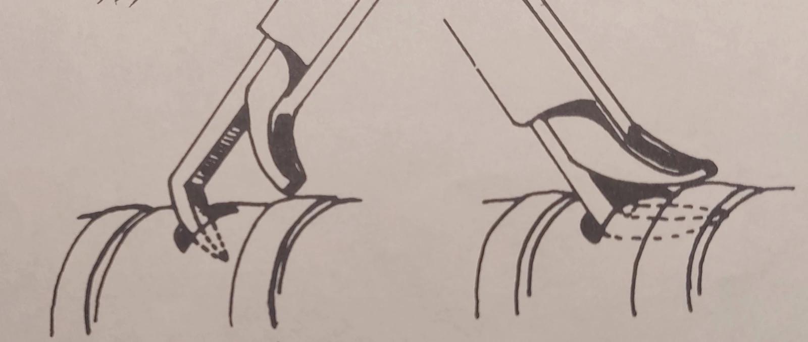 Drawing showing the use of the tracheotomy punch.