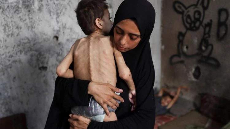 A mother in Gaza holds her starving young boy