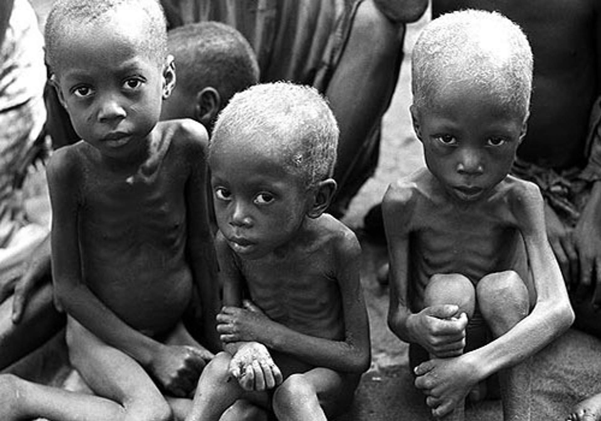 Three malnourished children sit close together, looking at the camera.